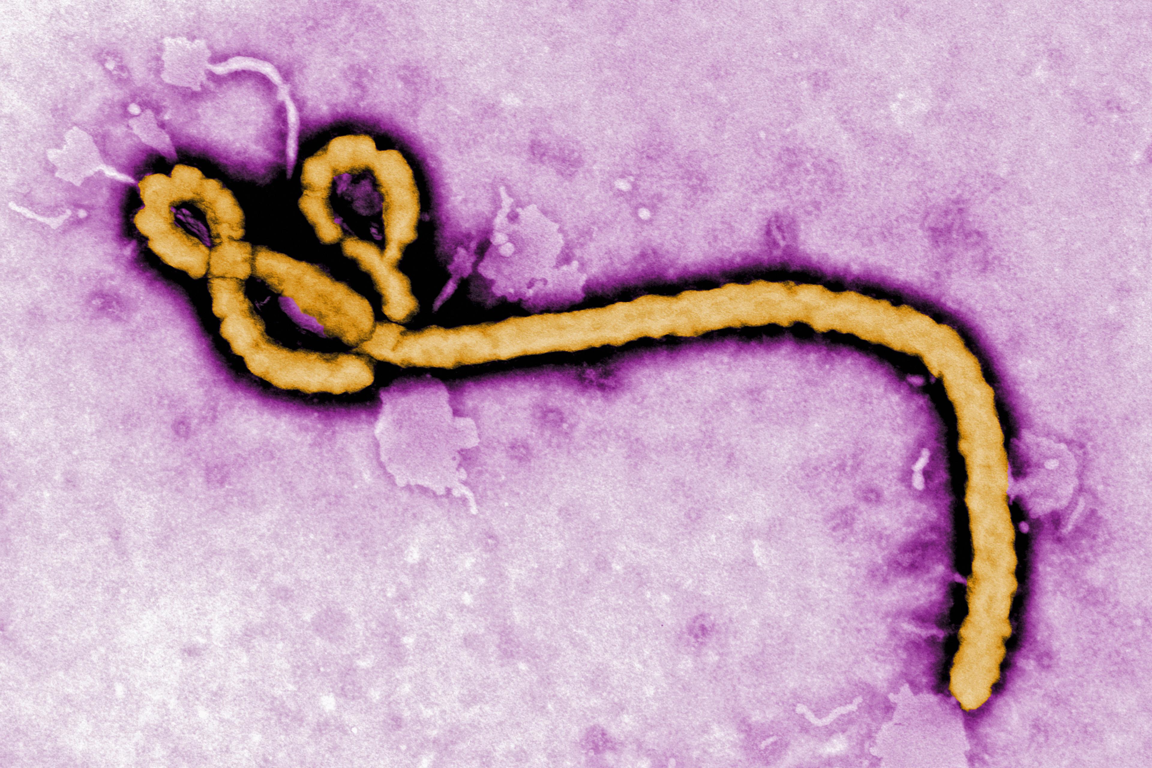 Ebola