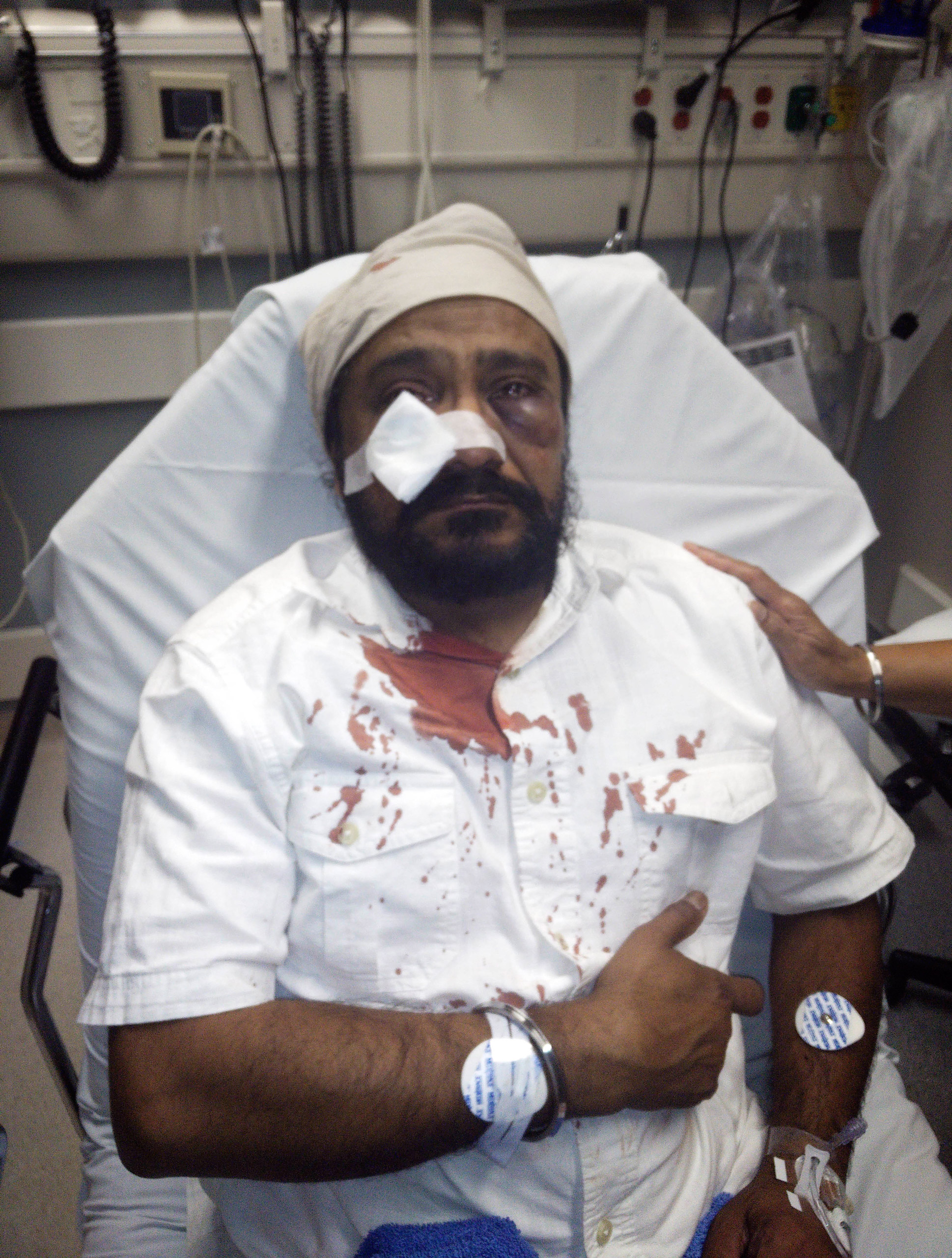 In this Sept. 8, 2015 photo provided by The Sikh Coaliton, 53-year-old Inderjit Mukker is seen at a hospital in Hinsdale, Ill., following an attack authorities say was a road rage incident in Darien, Ill. On Tuesday, Sept. 15, prosecutors said a suburban