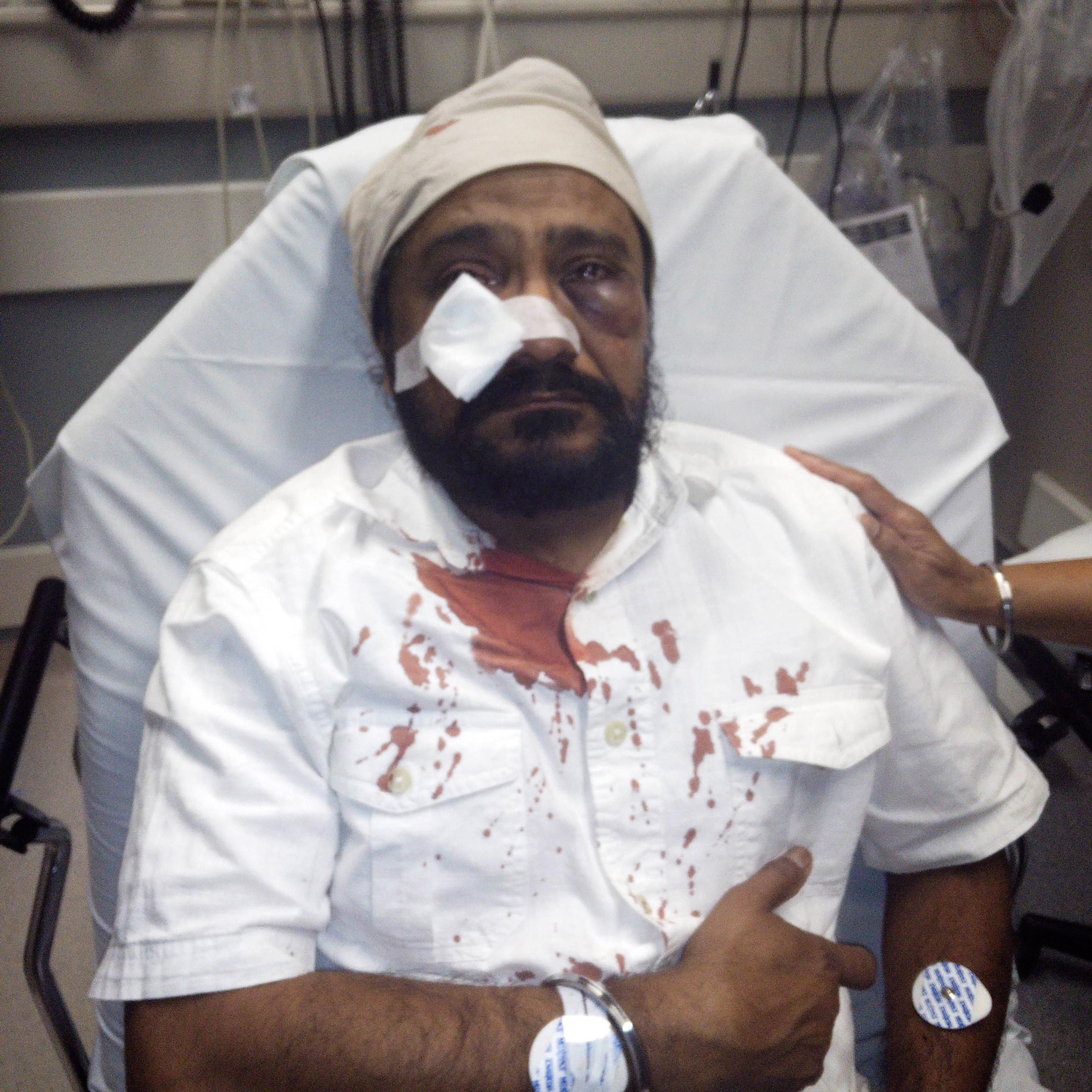 In this Sept. 8, 2015 photo provided by The Sikh Coaliton, 53-year-old Inderjit Mukker is seen at a hospital in Hinsdale, Ill., following an attack authorities say was a road rage incident in Darien, Ill. On Tuesday, Sept. 15, prosecutors said a suburban