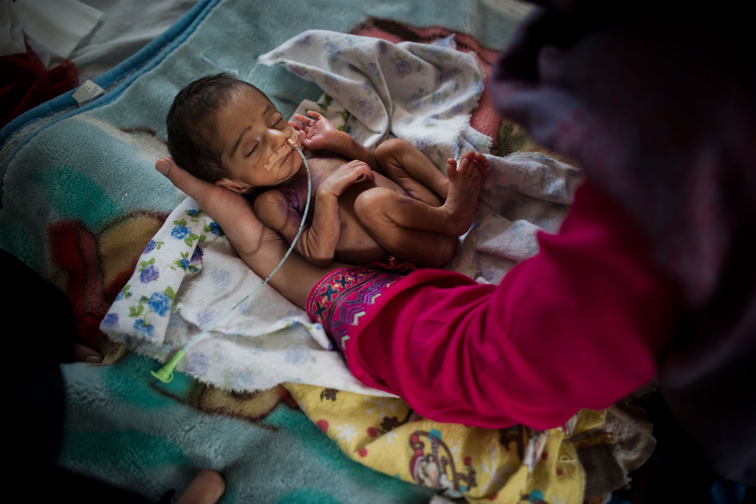 Pediatric nurse Isabelle Arnould examines a baby in the neonatal ward at the MSF Maternity Hospital in Khost.