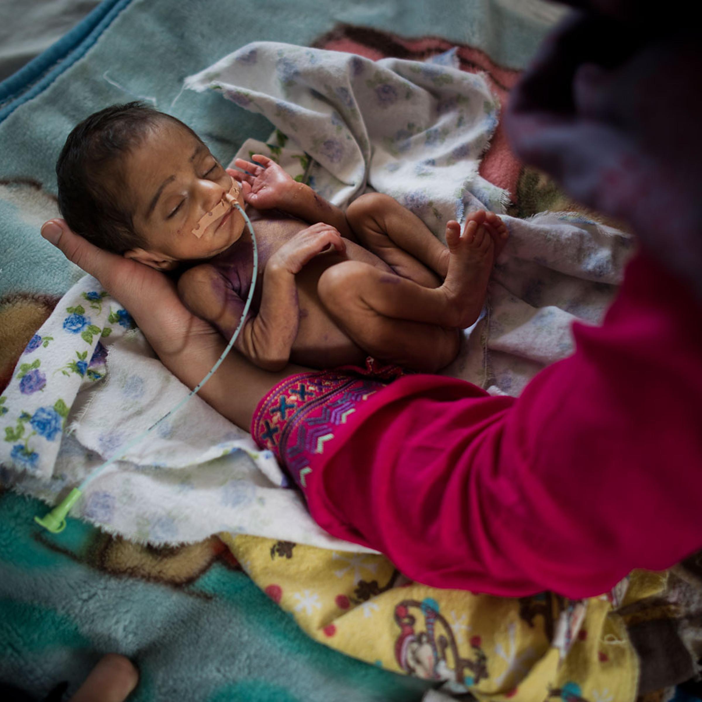 Pediatric nurse Isabelle Arnould examines a baby in the neonatal ward at the MSF Maternity Hospital in Khost.