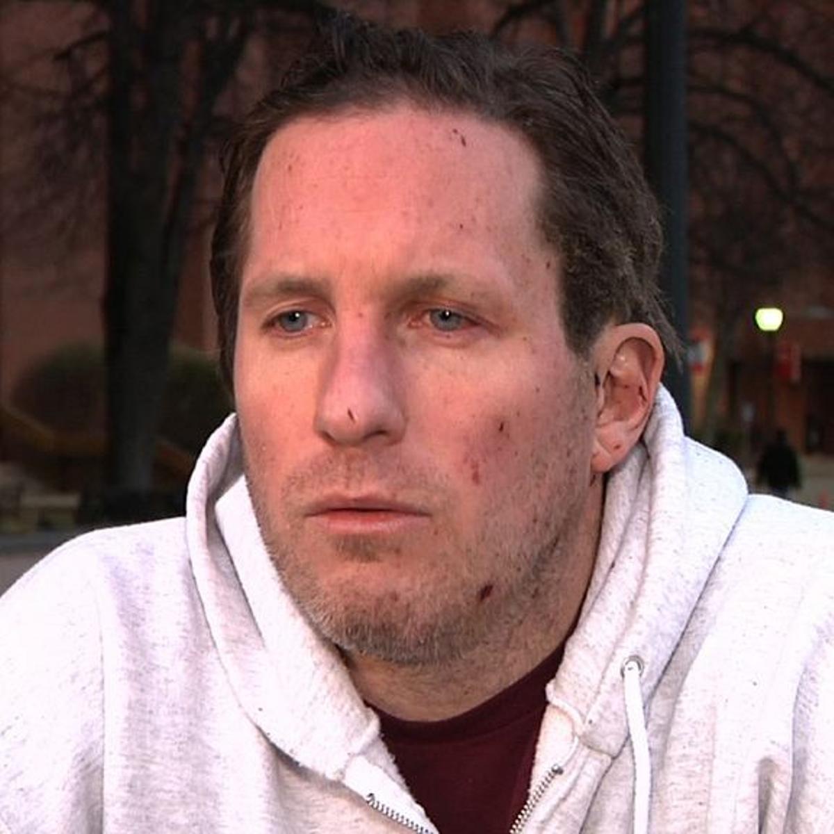 This image from video shows Boston Marathon bombing victim Kevin White during an interview with the Associated Press on April 17, 2013.
