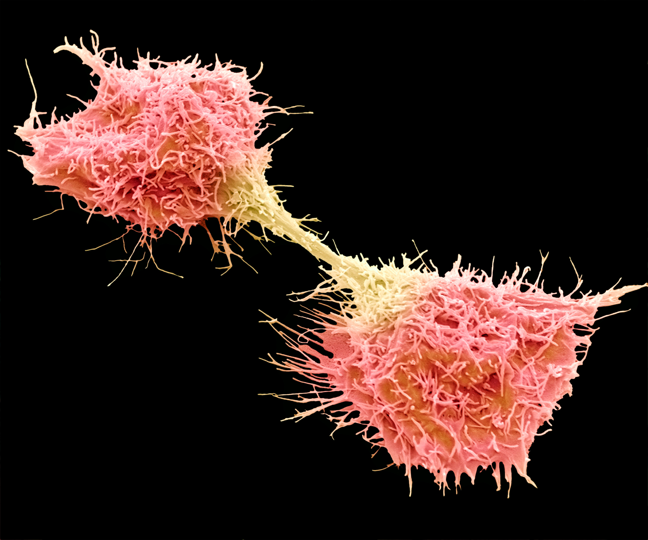 Cancer cells