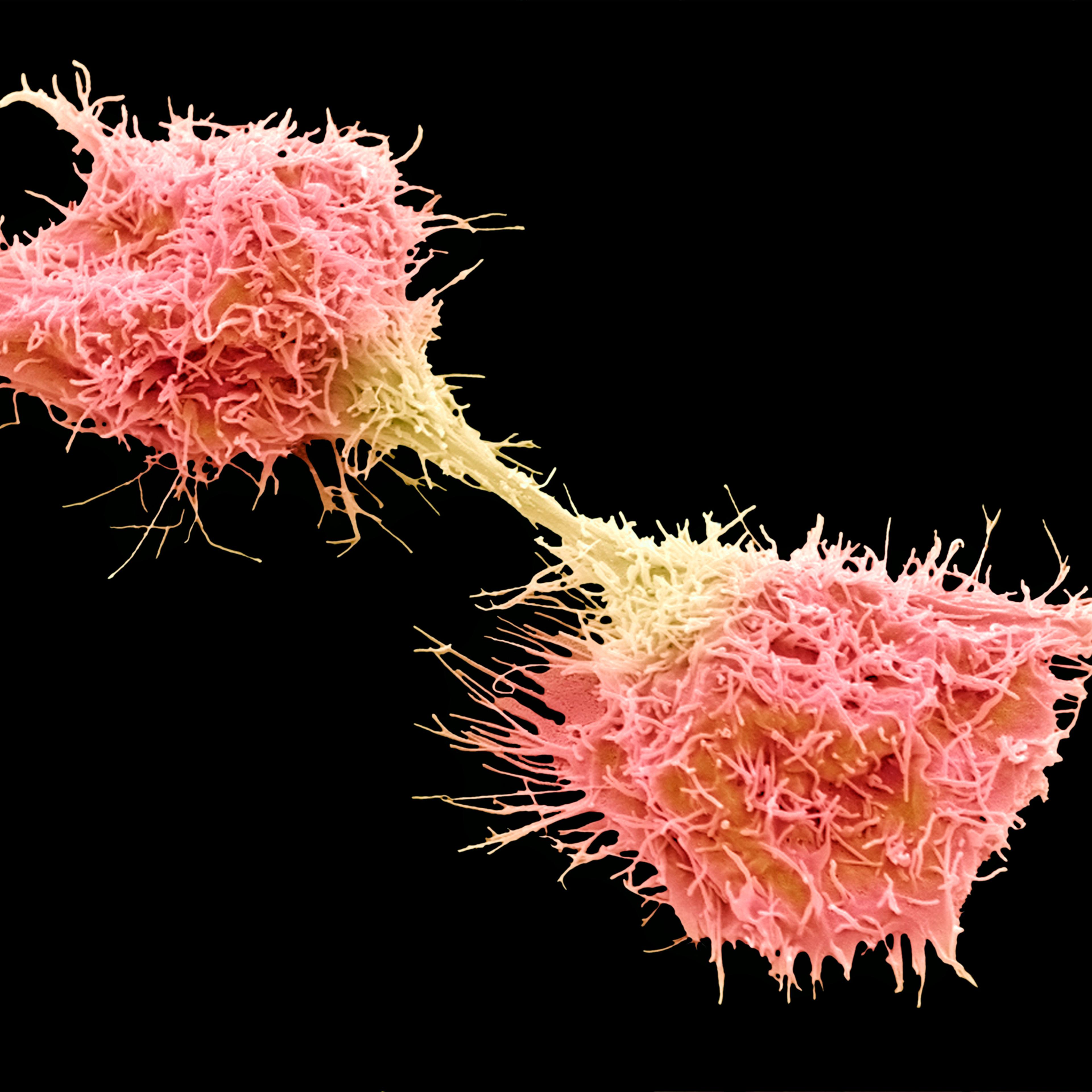 Cancer cells