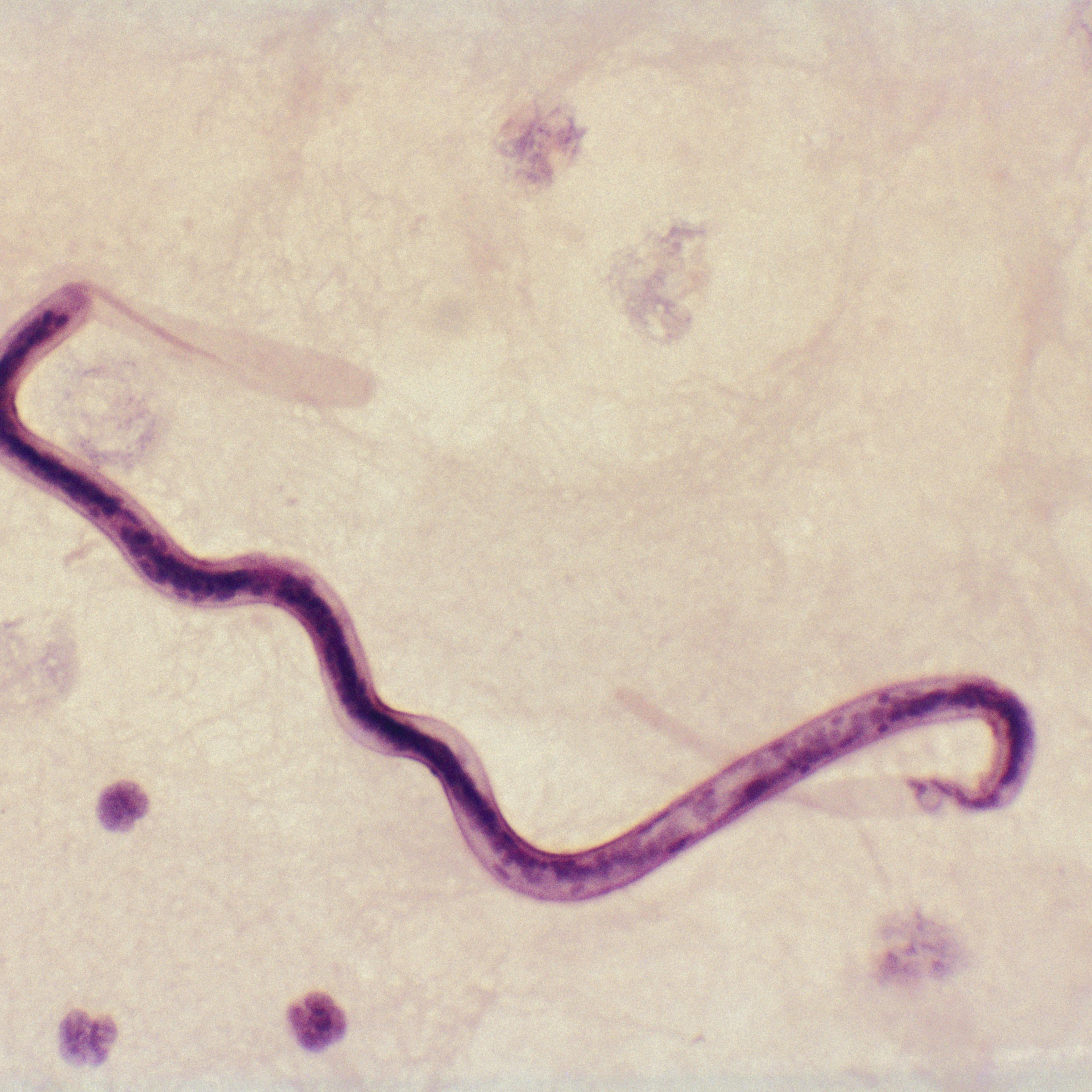 loa loa worm parasite