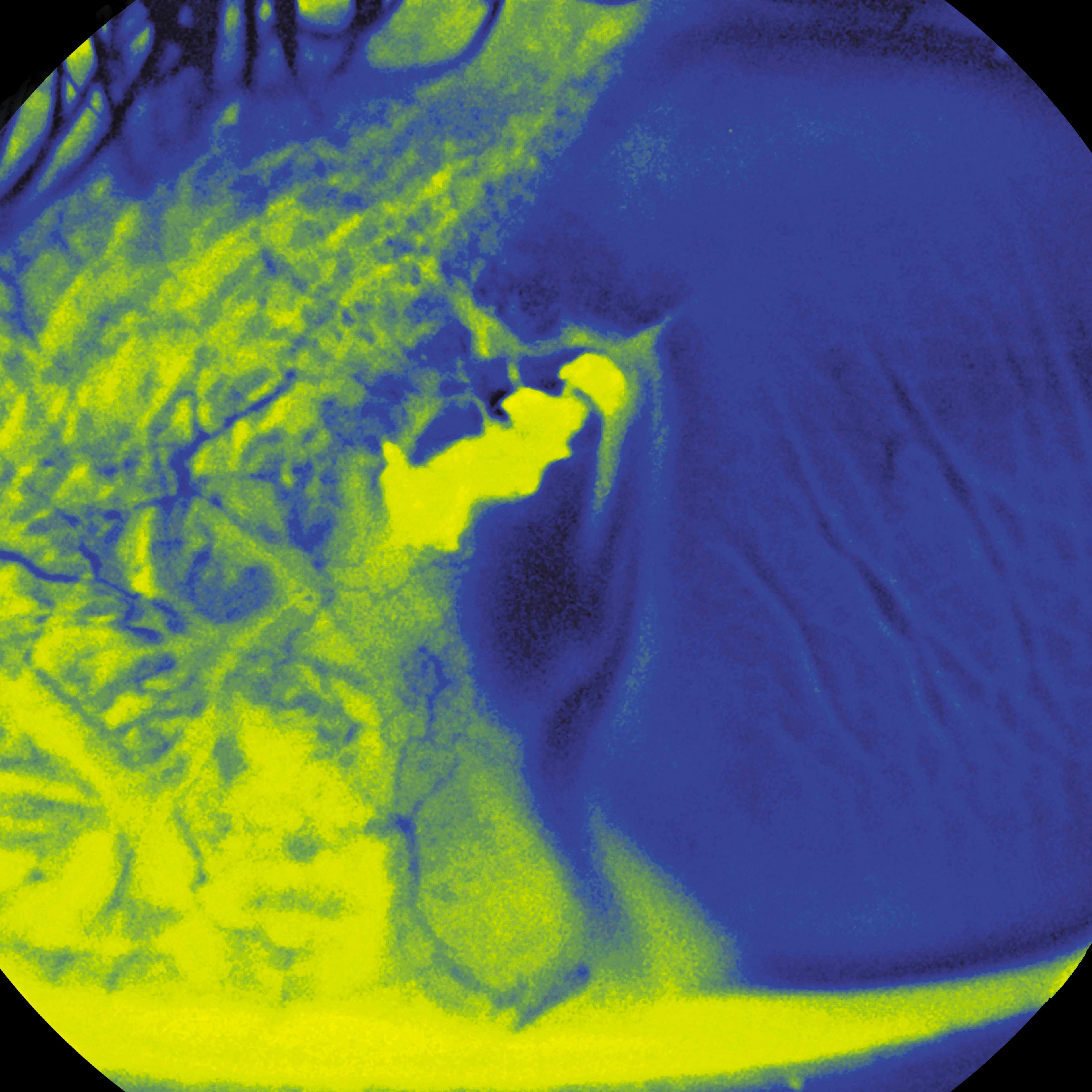 Injured Cornea