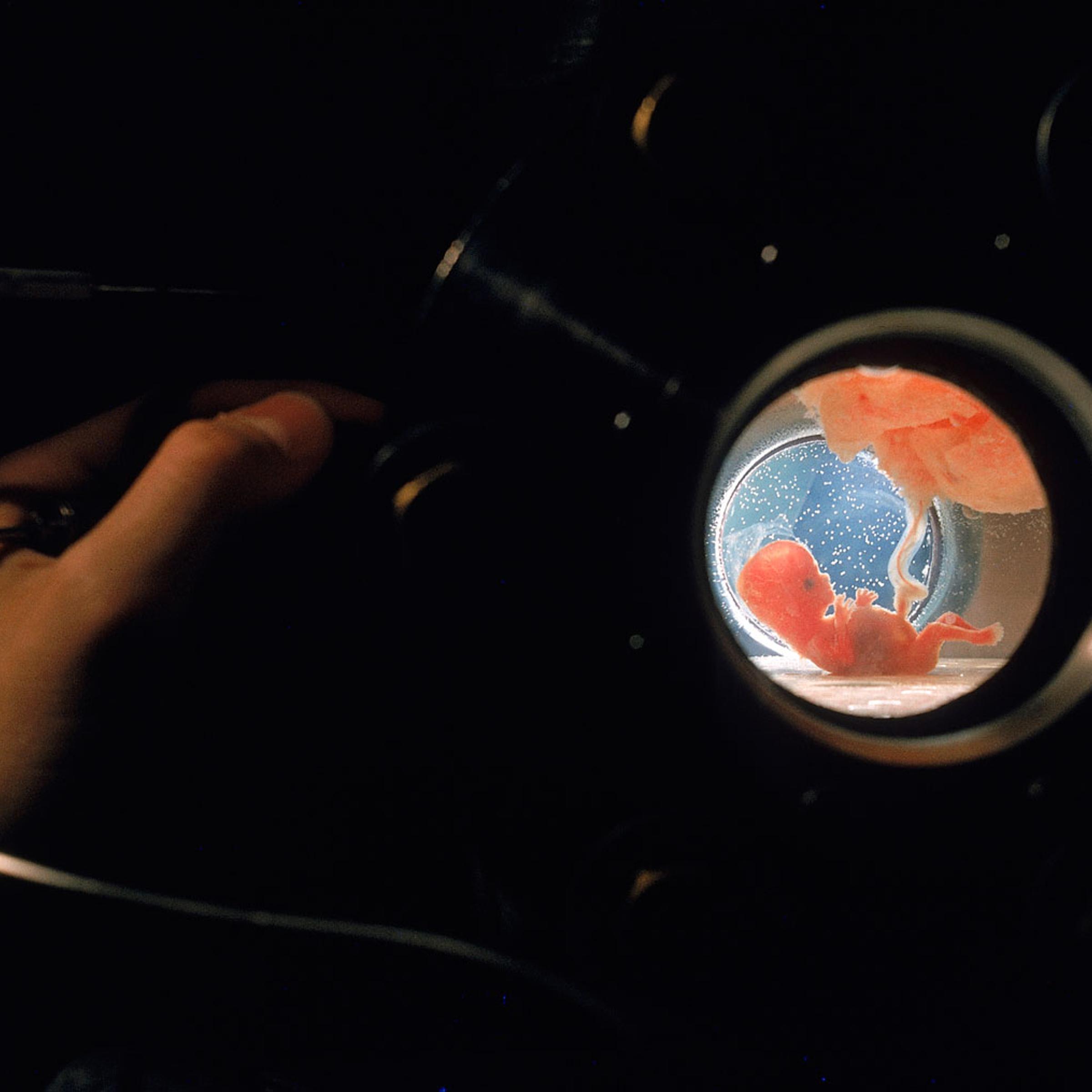 Seen through porthole, a fetus, attached by umbilical cord to placenta floating above it, gets oxygen through skin from surrounding fluid. Hand at left is adjusting valve to let in nutrients.