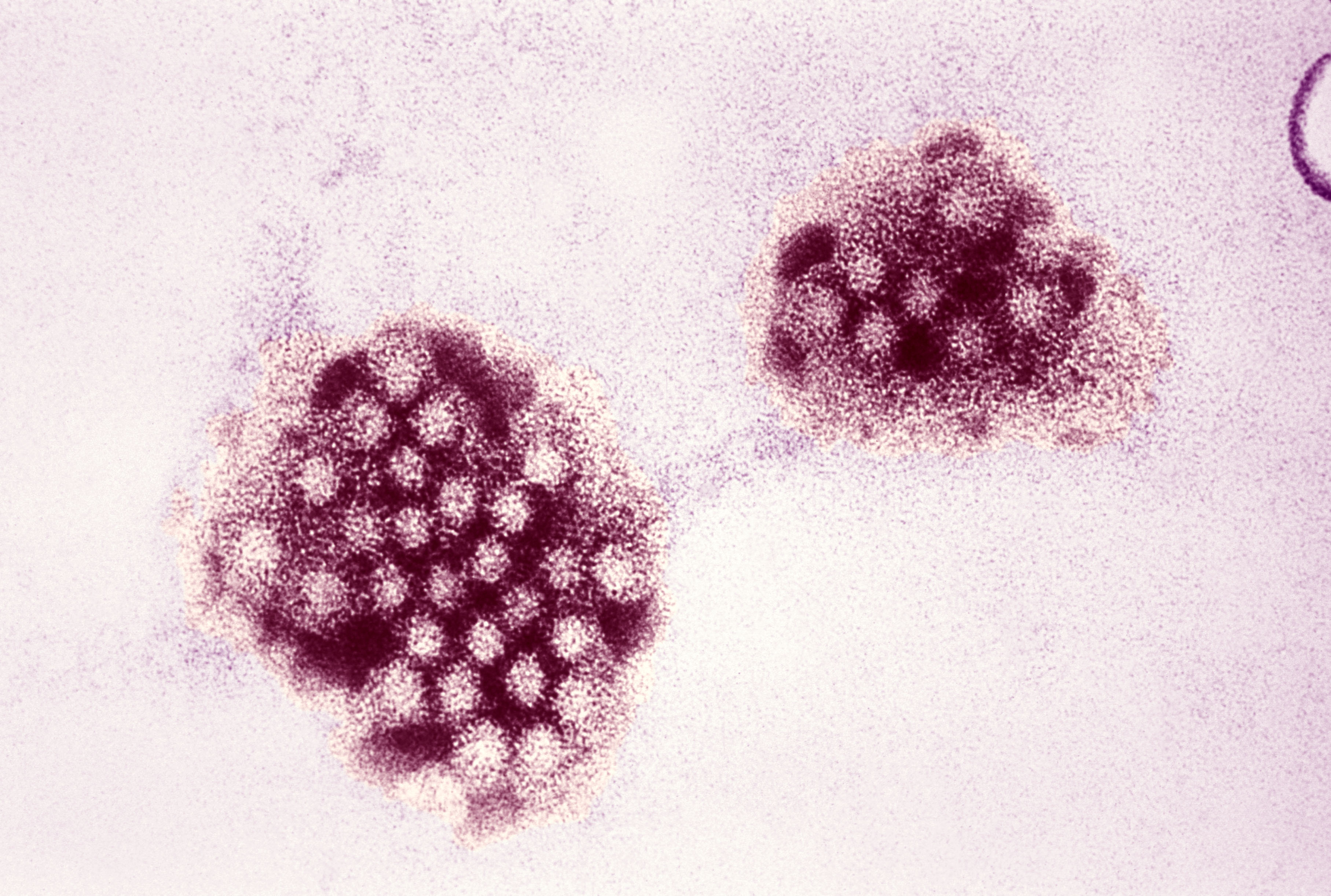 Norwalk Virus
