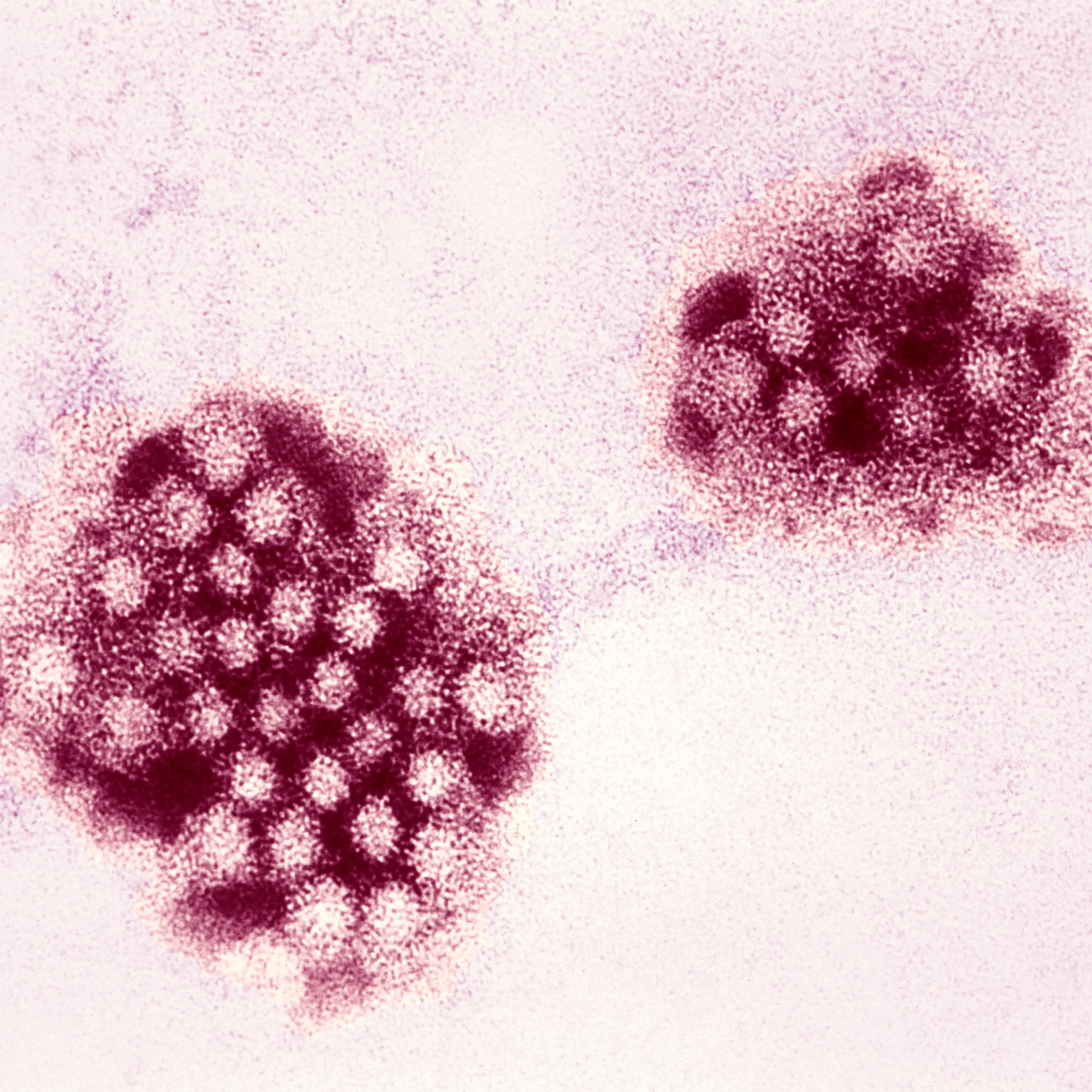Norwalk Virus
