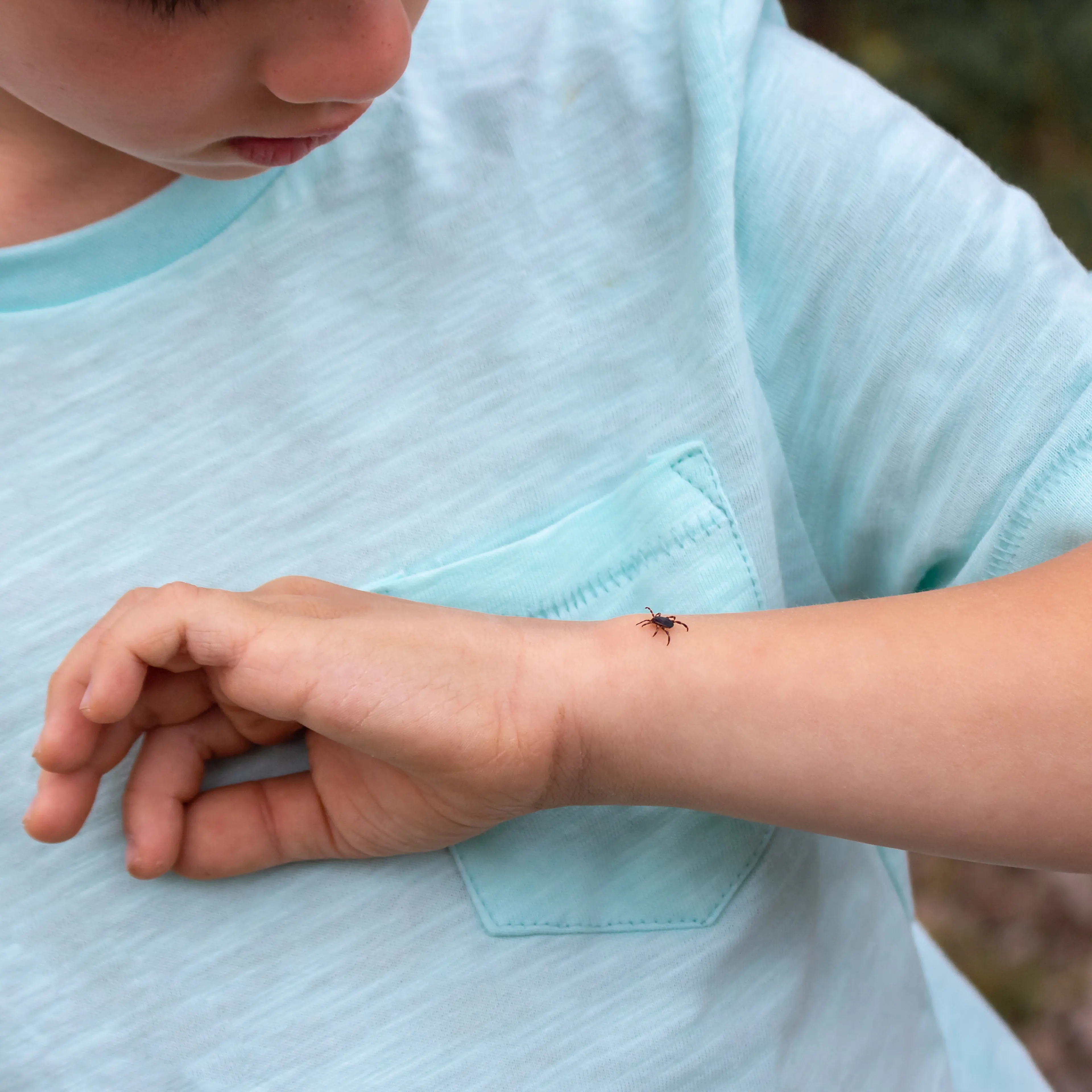 A tick on a child