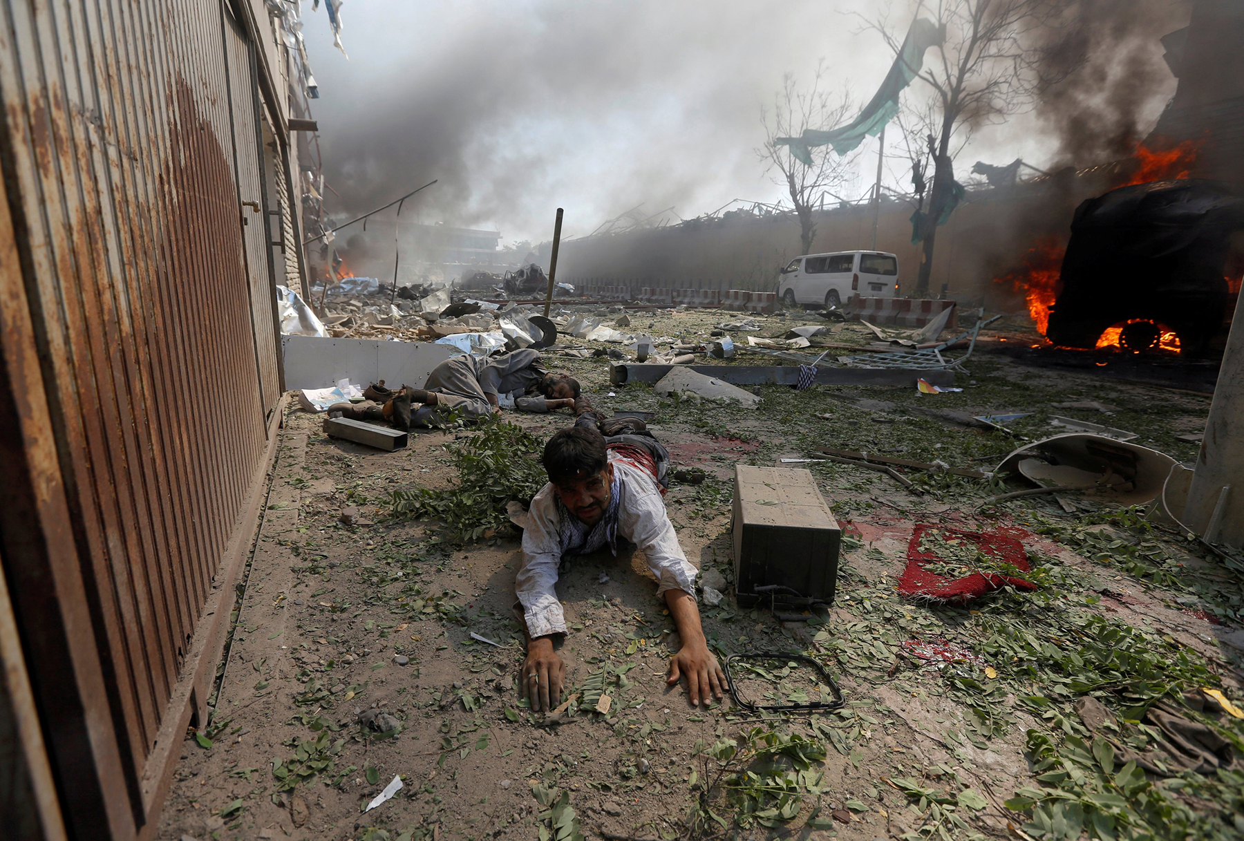 A wounded man lies on the ground after a massive blast in Kabul on May 31, 2017.