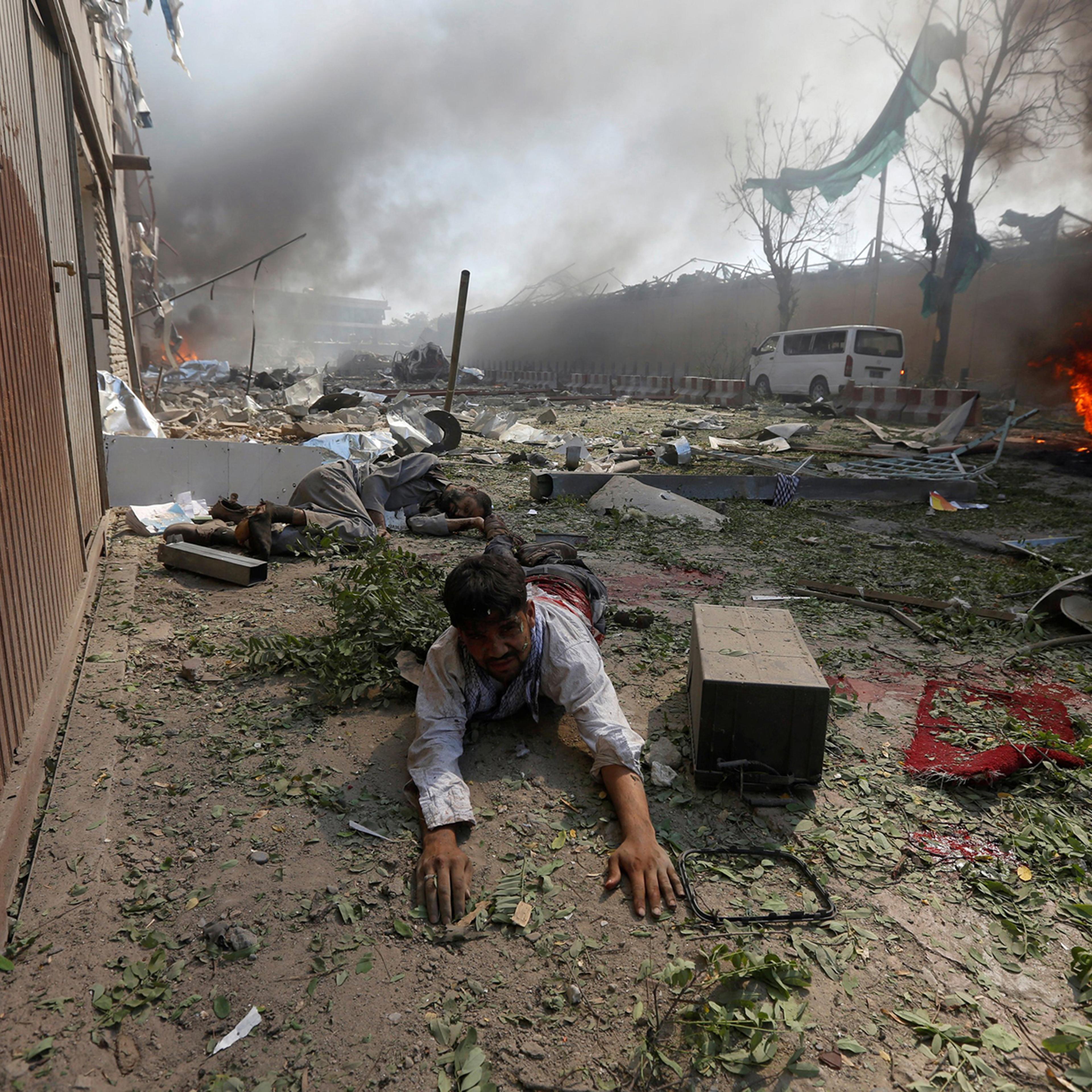 A wounded man lies on the ground after a massive blast in Kabul on May 31, 2017.