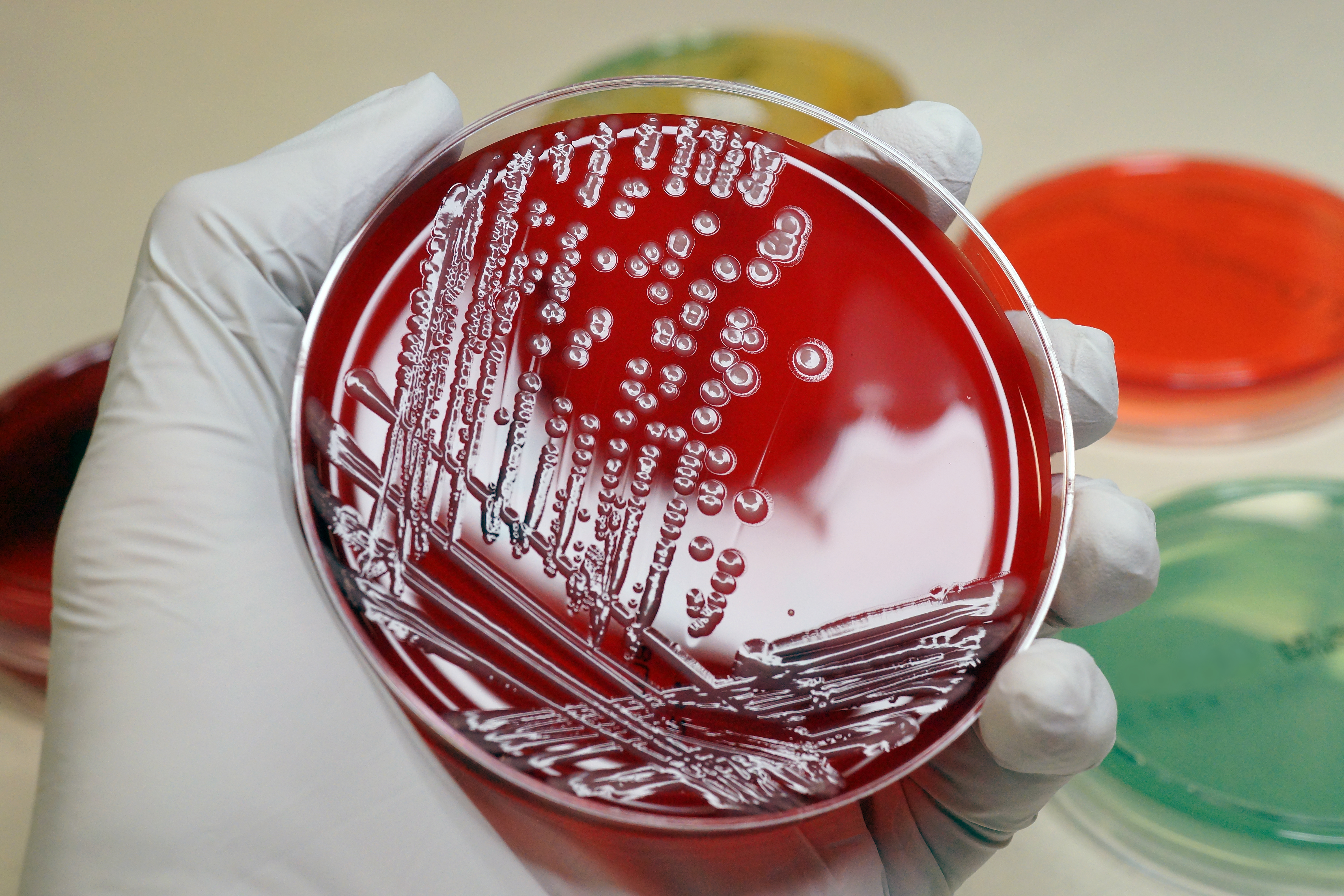 Multi-resistant coliform bacteria