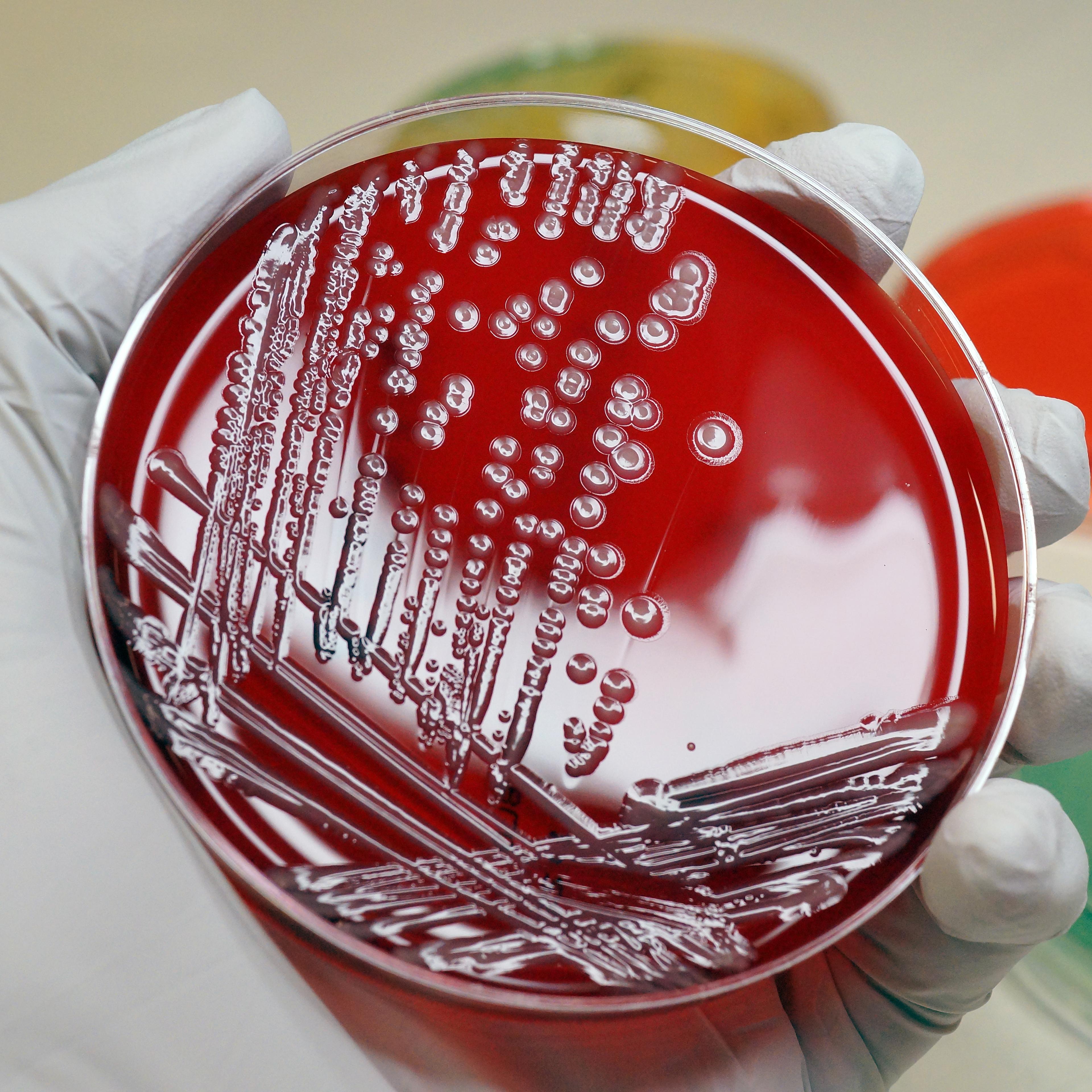 Multi-resistant coliform bacteria