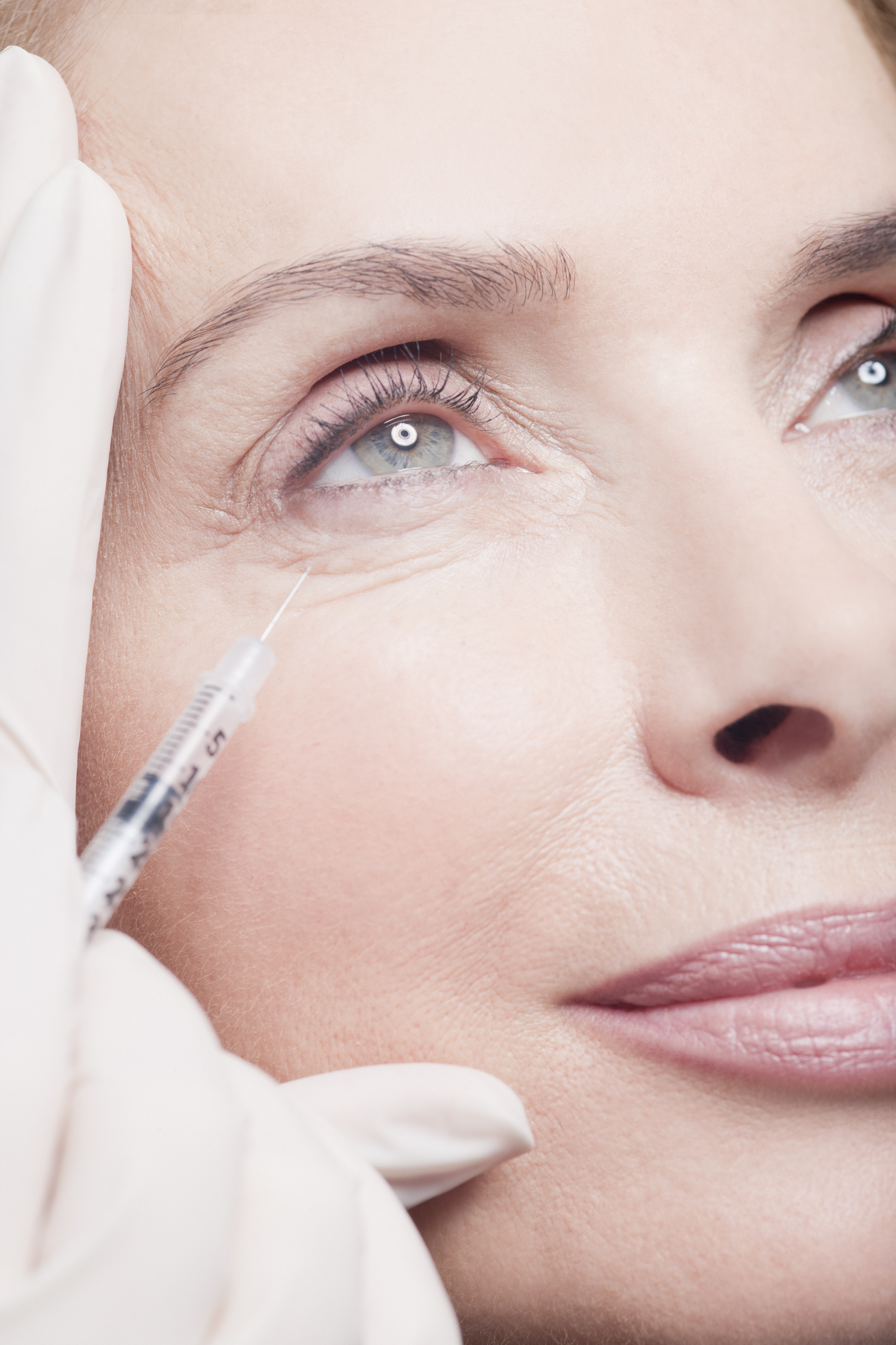 FDA Approves Botox for Reducing Crow’s Feet