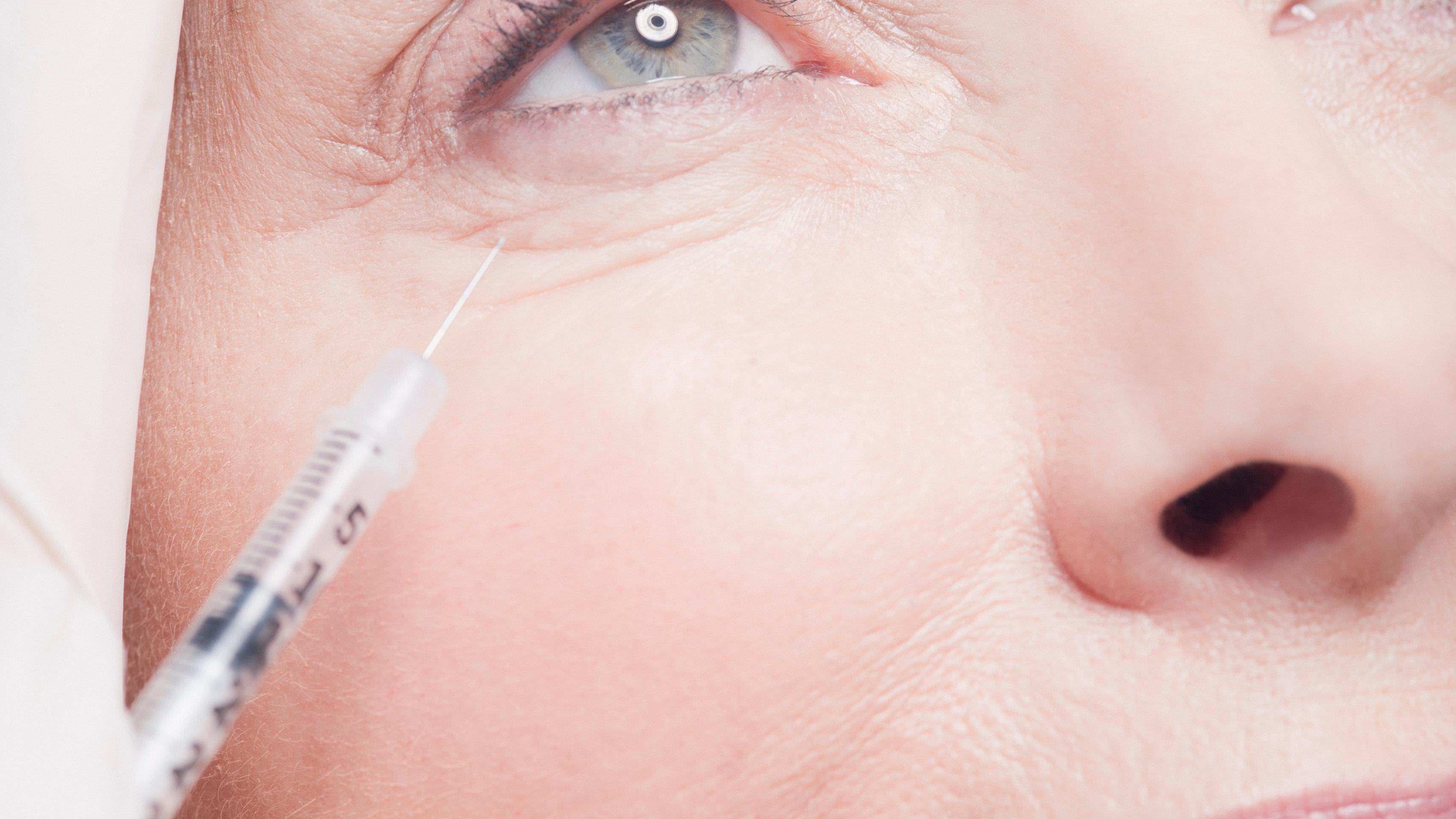 Eye Injectable FDA Approves Botox for Reducing Crow’s Feet