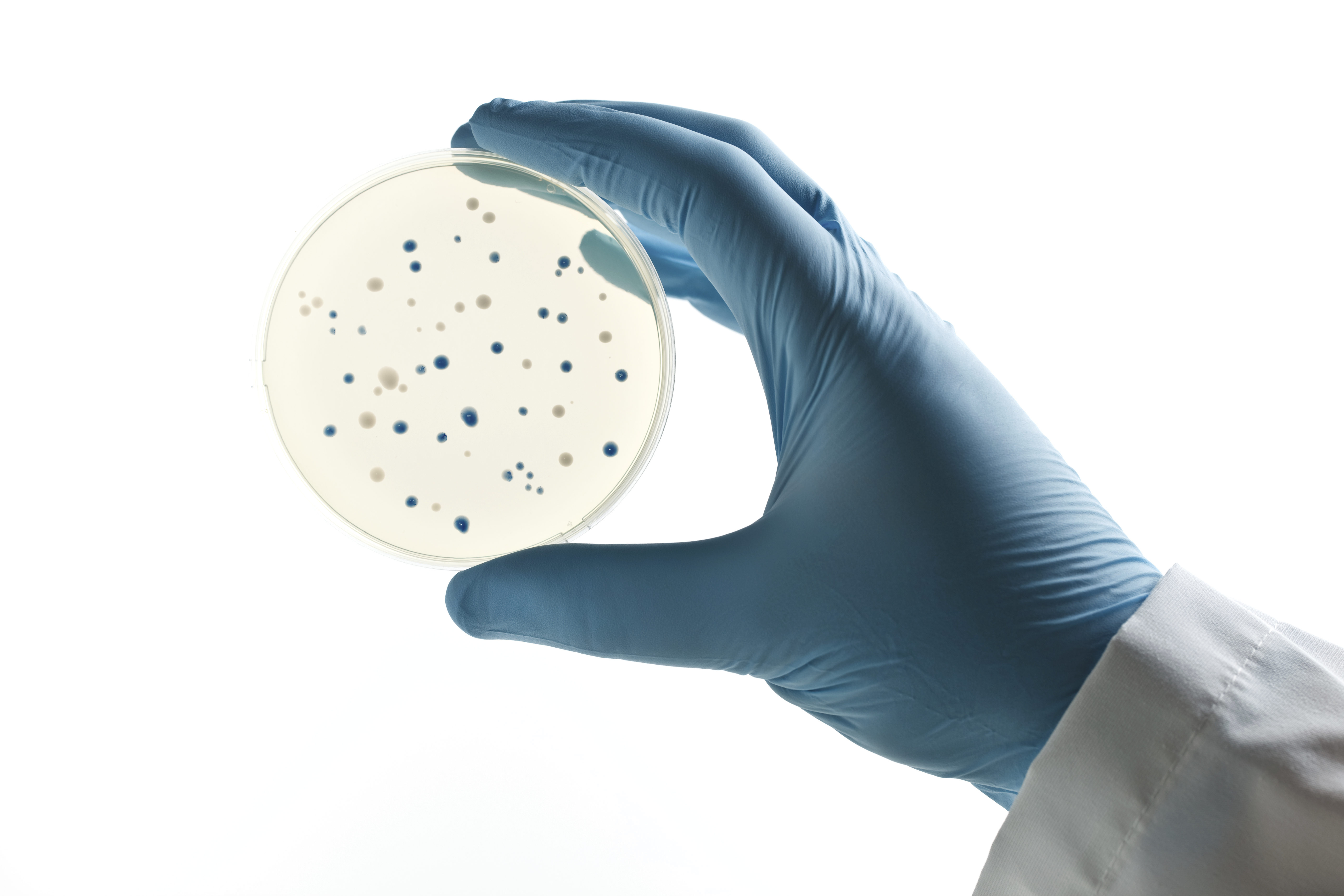 Scientist holding a Petri dish with bacterial clones