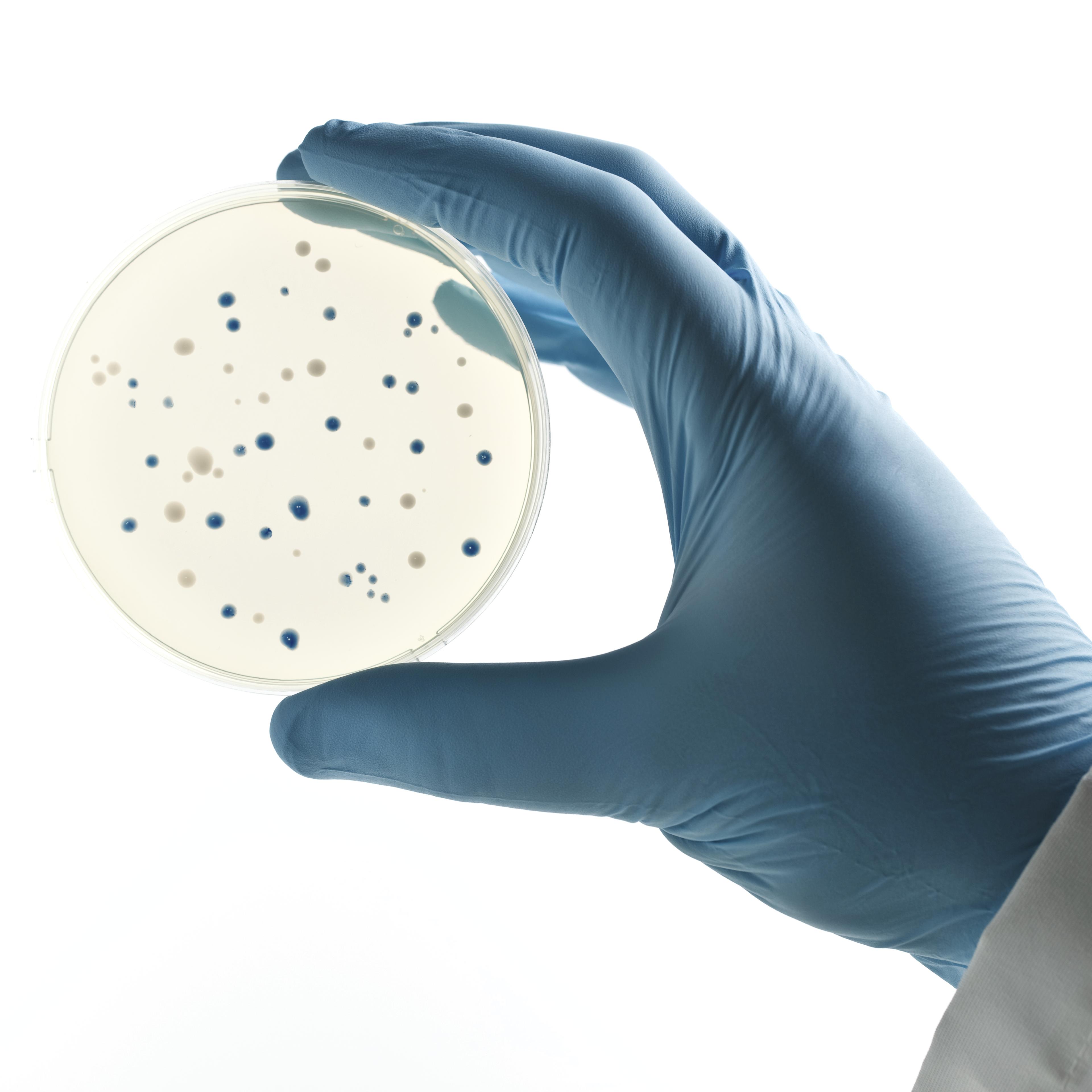 Scientist holding a Petri dish with bacterial clones