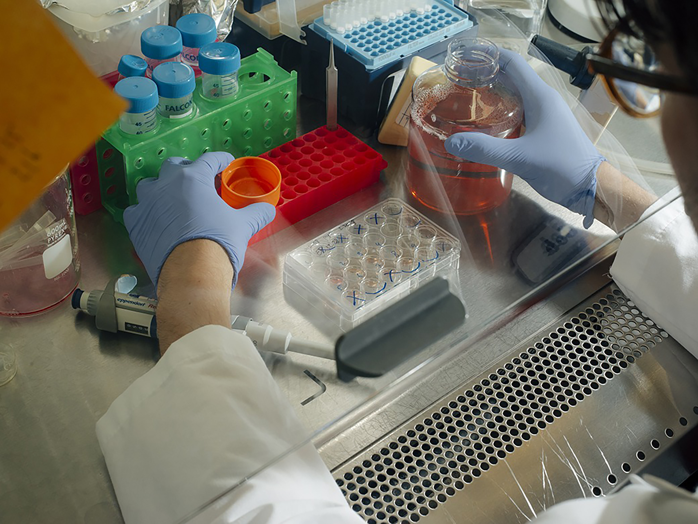 Stem Cells Mini Brains at Columbia University