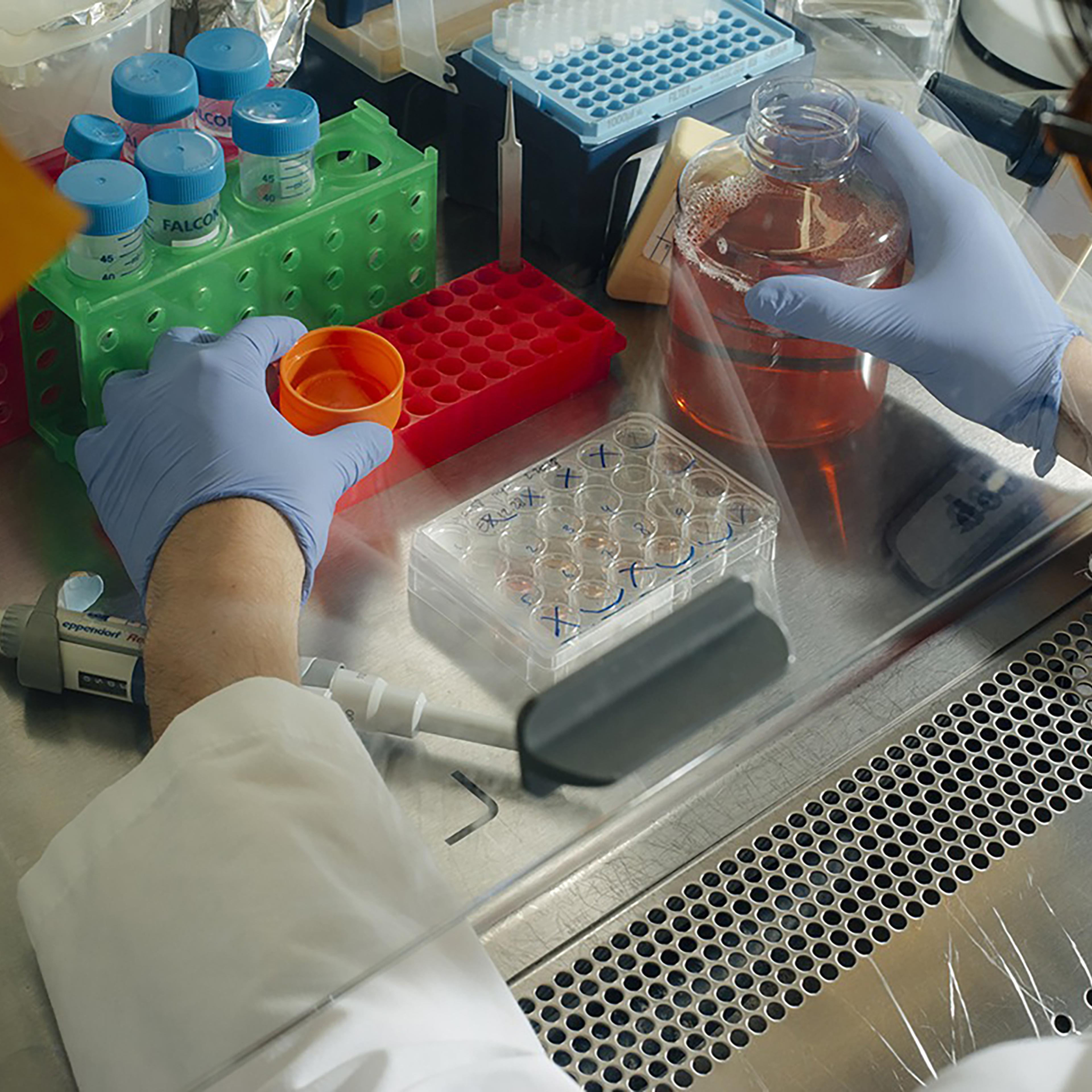 Stem Cells Mini Brains at Columbia University