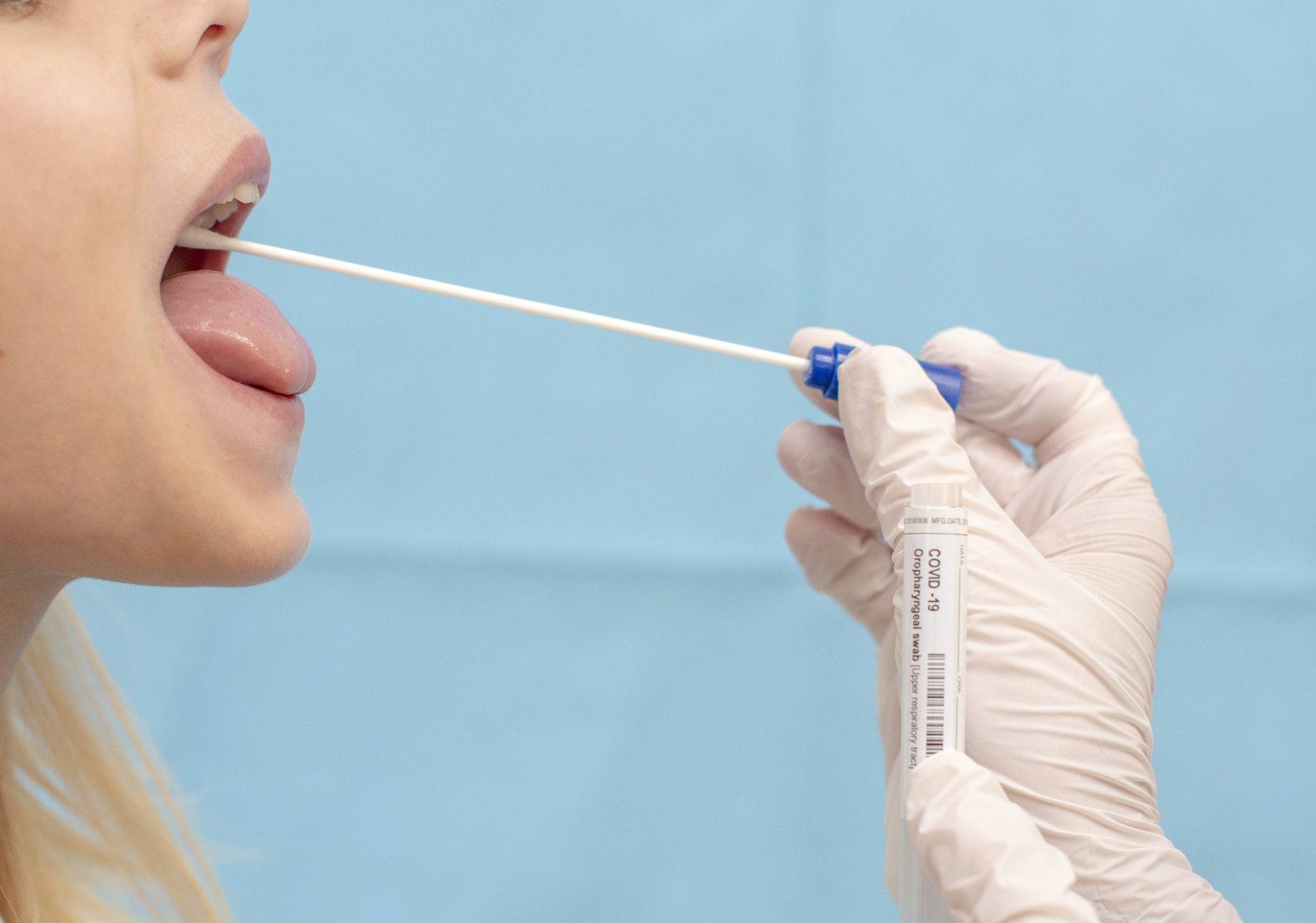 COVID-19 and Kawasaki disease