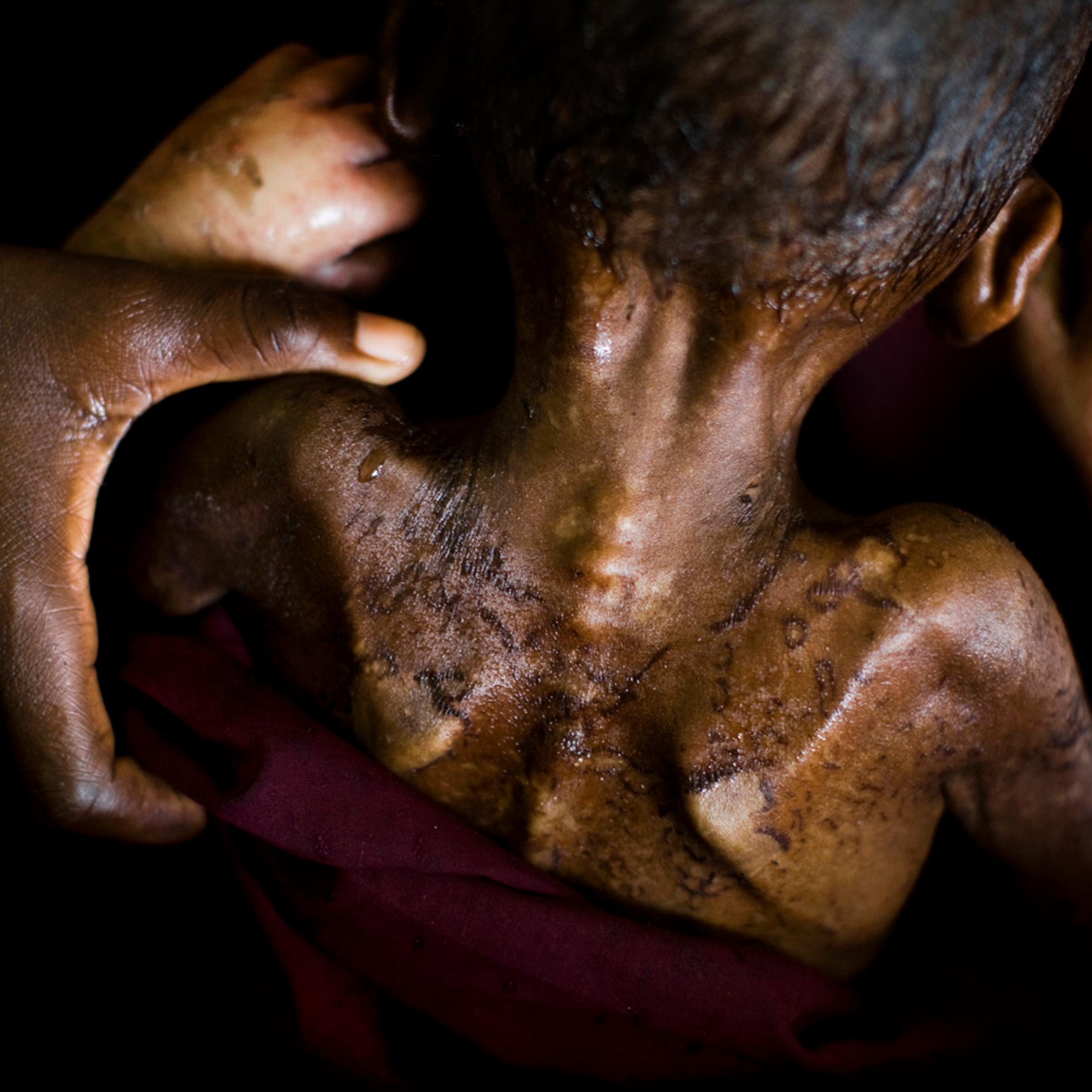Somalia, Dominic Nahr—Magnum for TIME