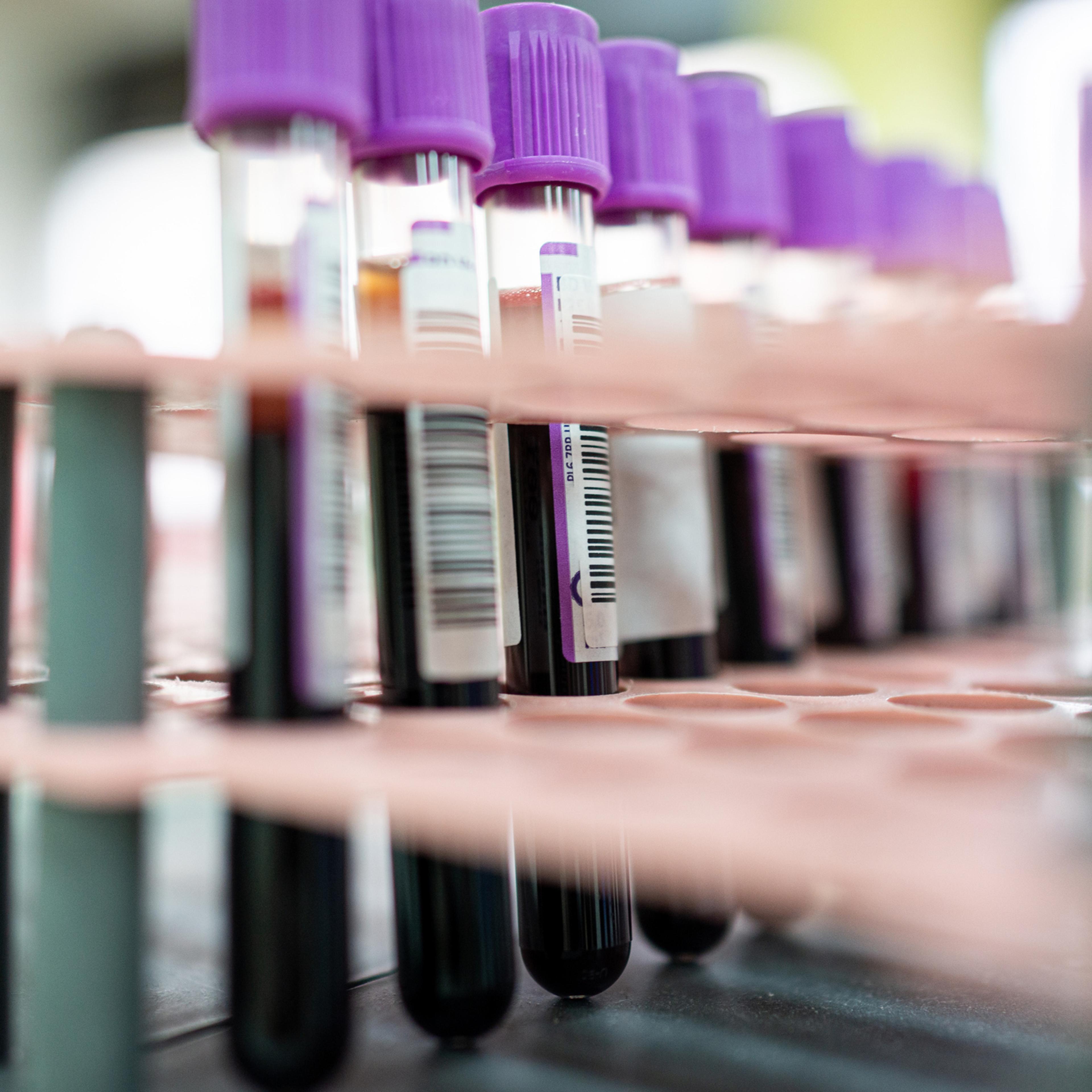 Blood samples in a laboratory