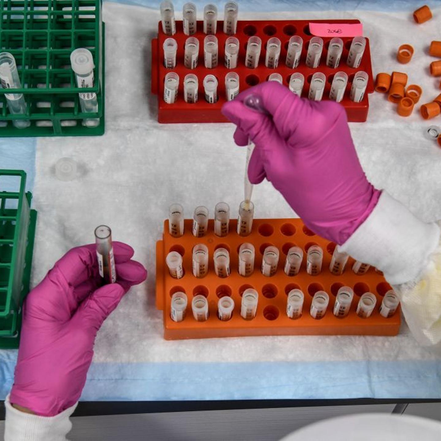 A lab technician sorts blood samples for COVID-19 vaccination study at the Research Centers of America in Hollywood, Florida on August 13, 2020.