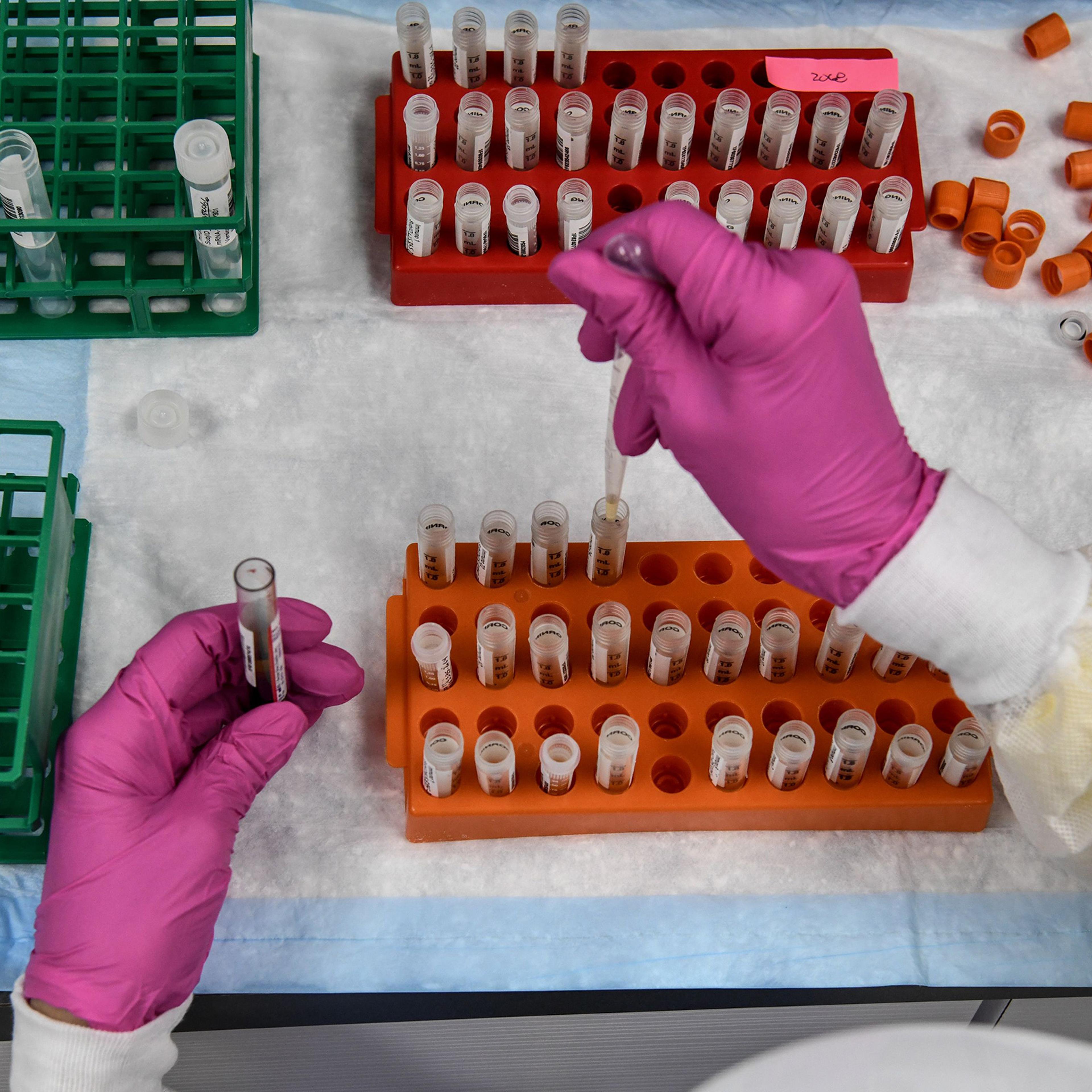 A lab technician sorts blood samples for COVID-19 vaccination study at the Research Centers of America in Hollywood, FL on Aug. 13