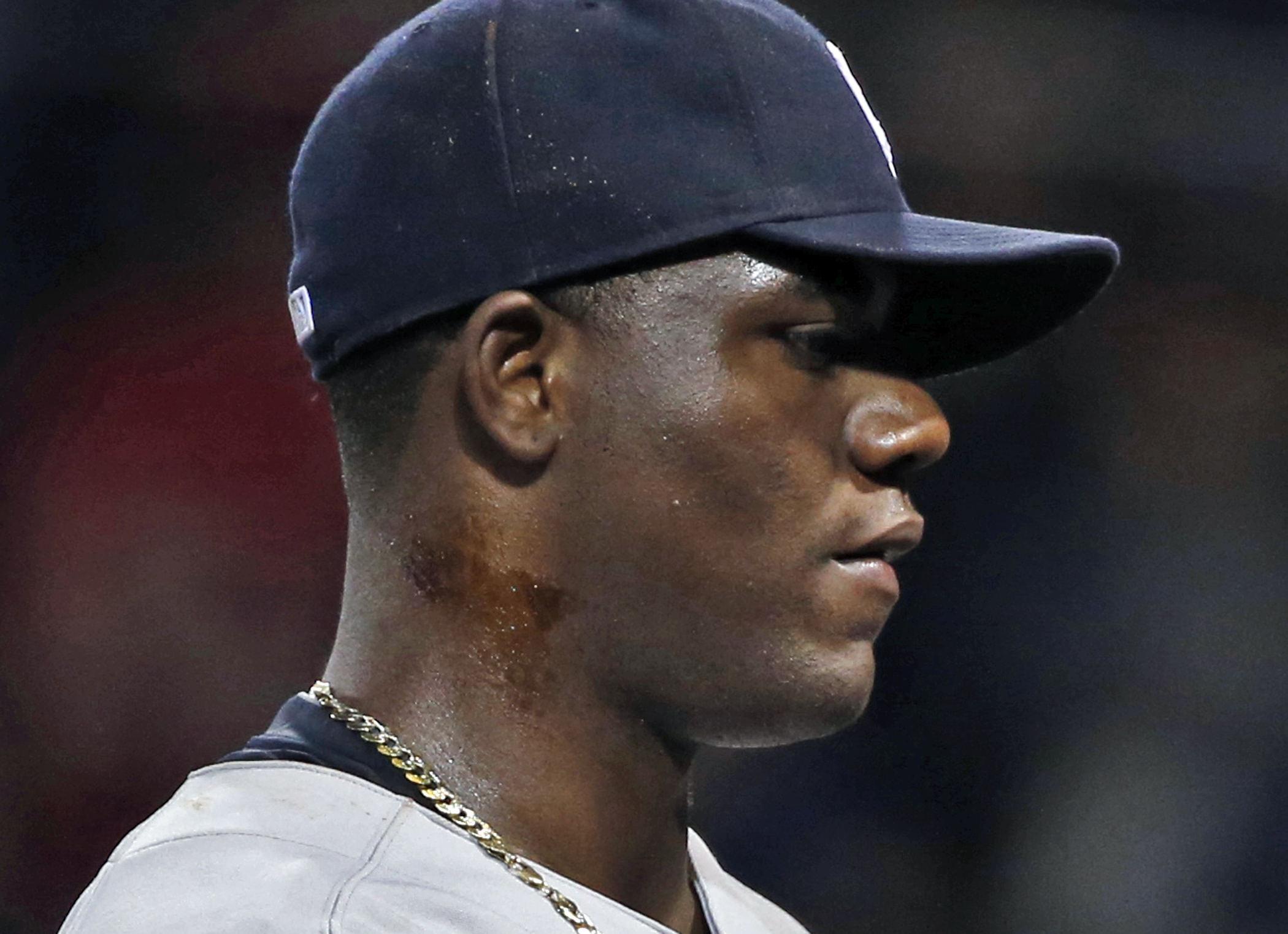Michael Pineda