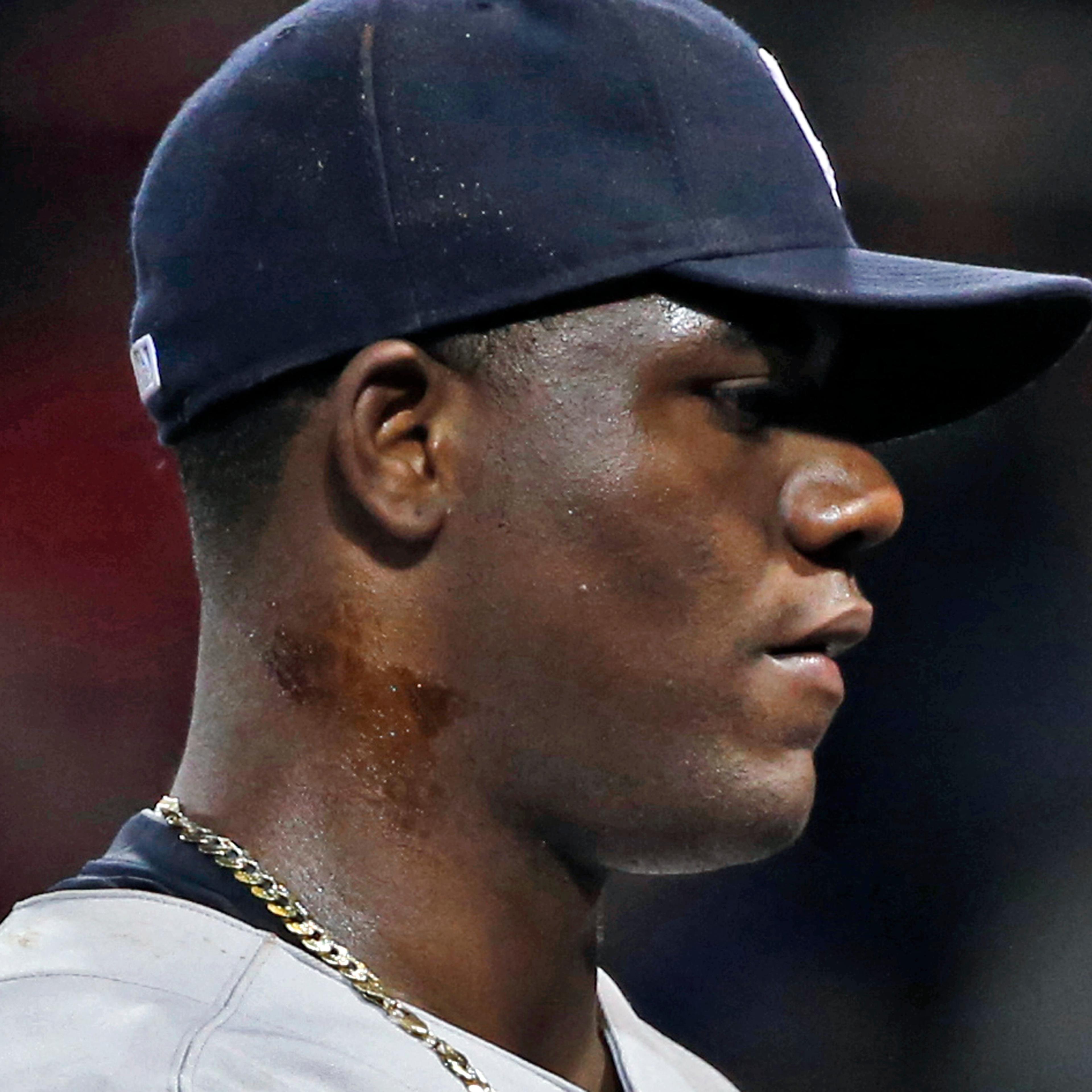 Michael Pineda