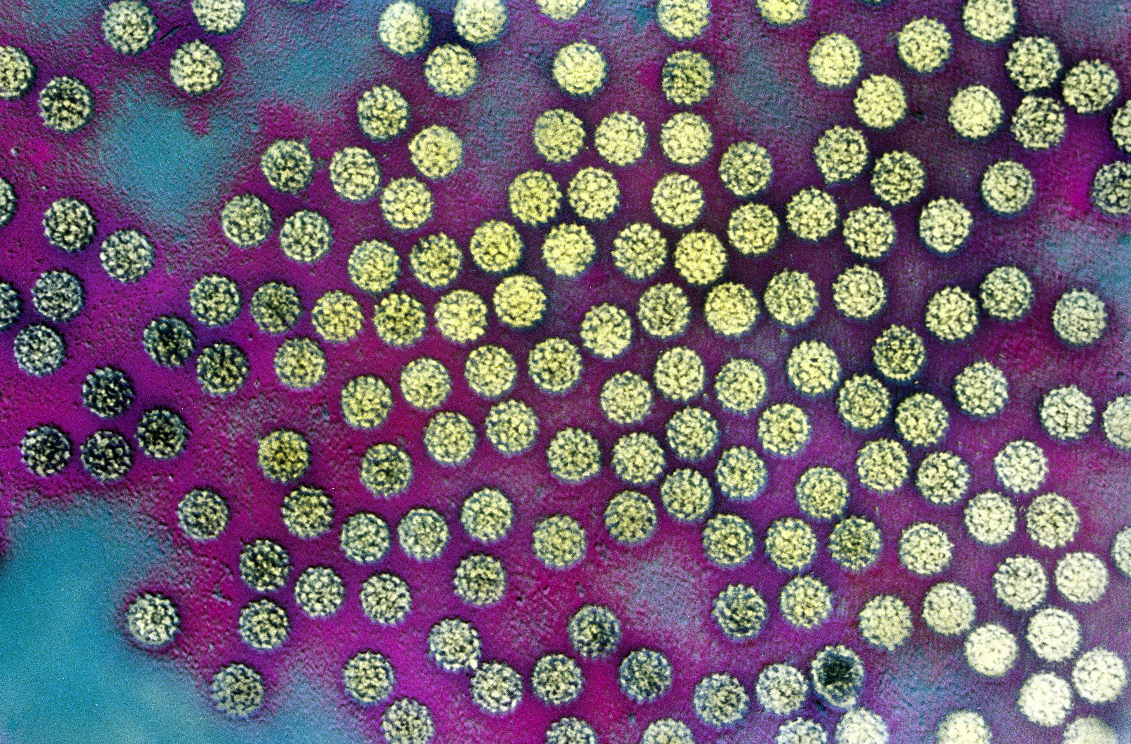 hpv image