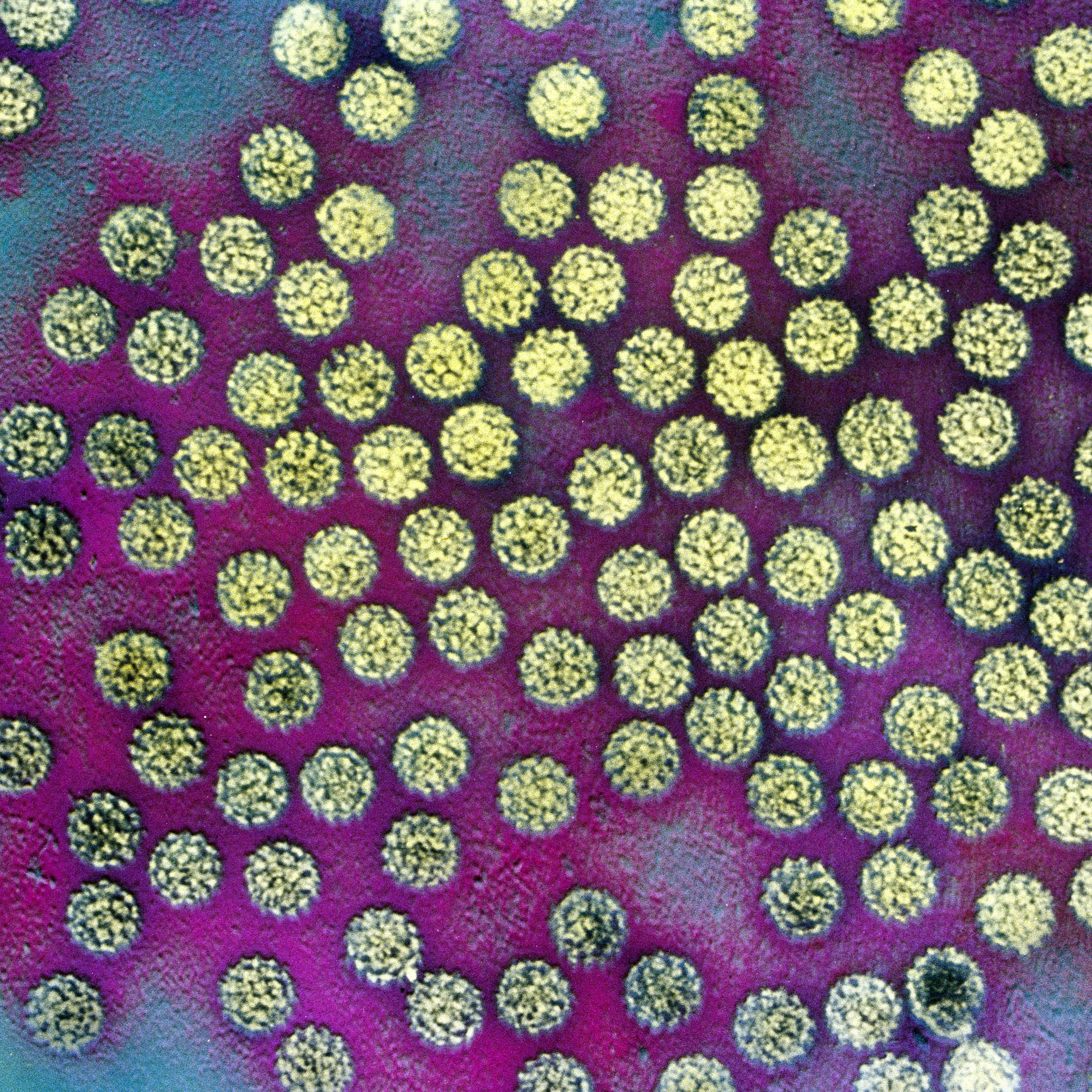 hpv image
