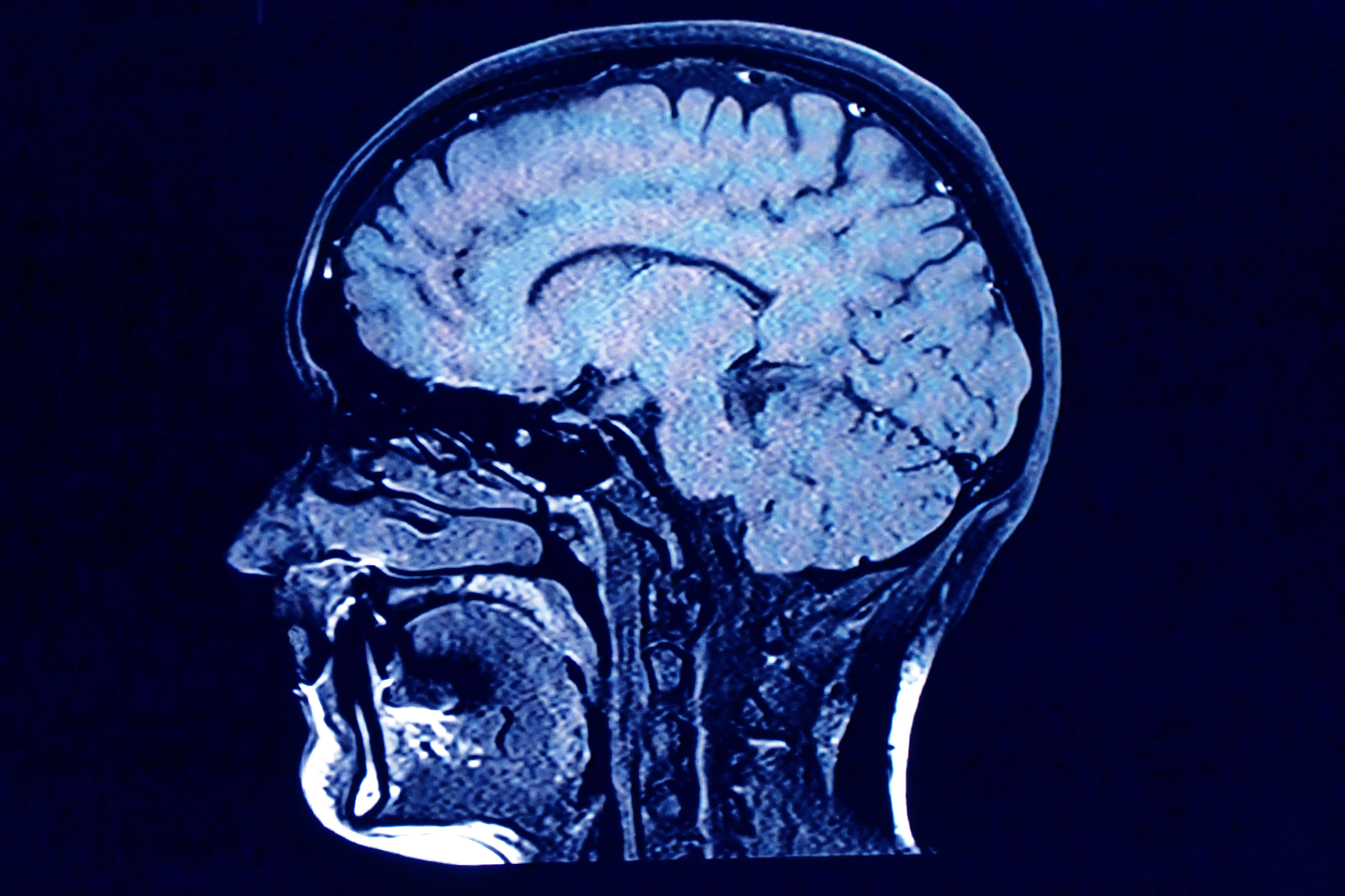 Brain head scan