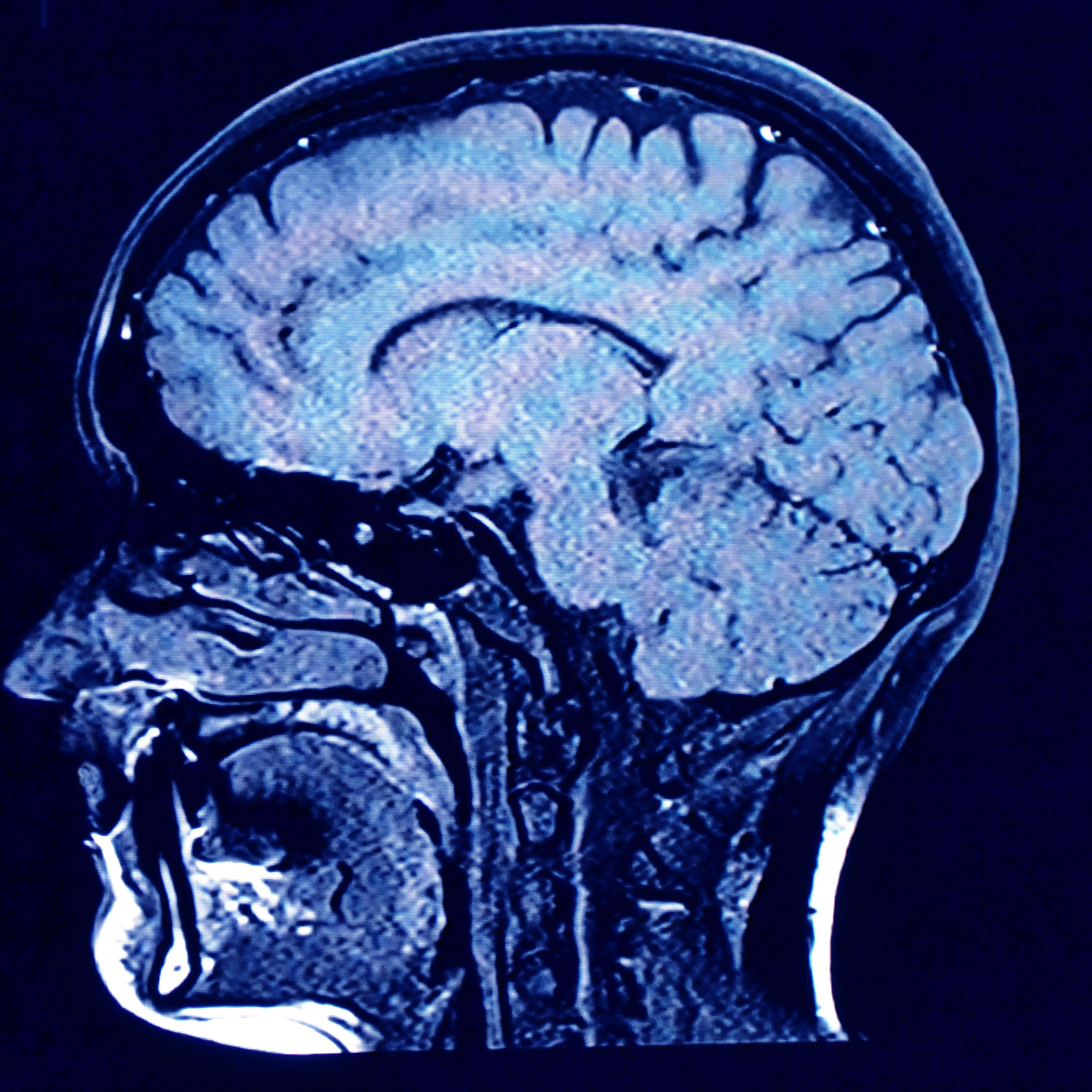 Brain head scan