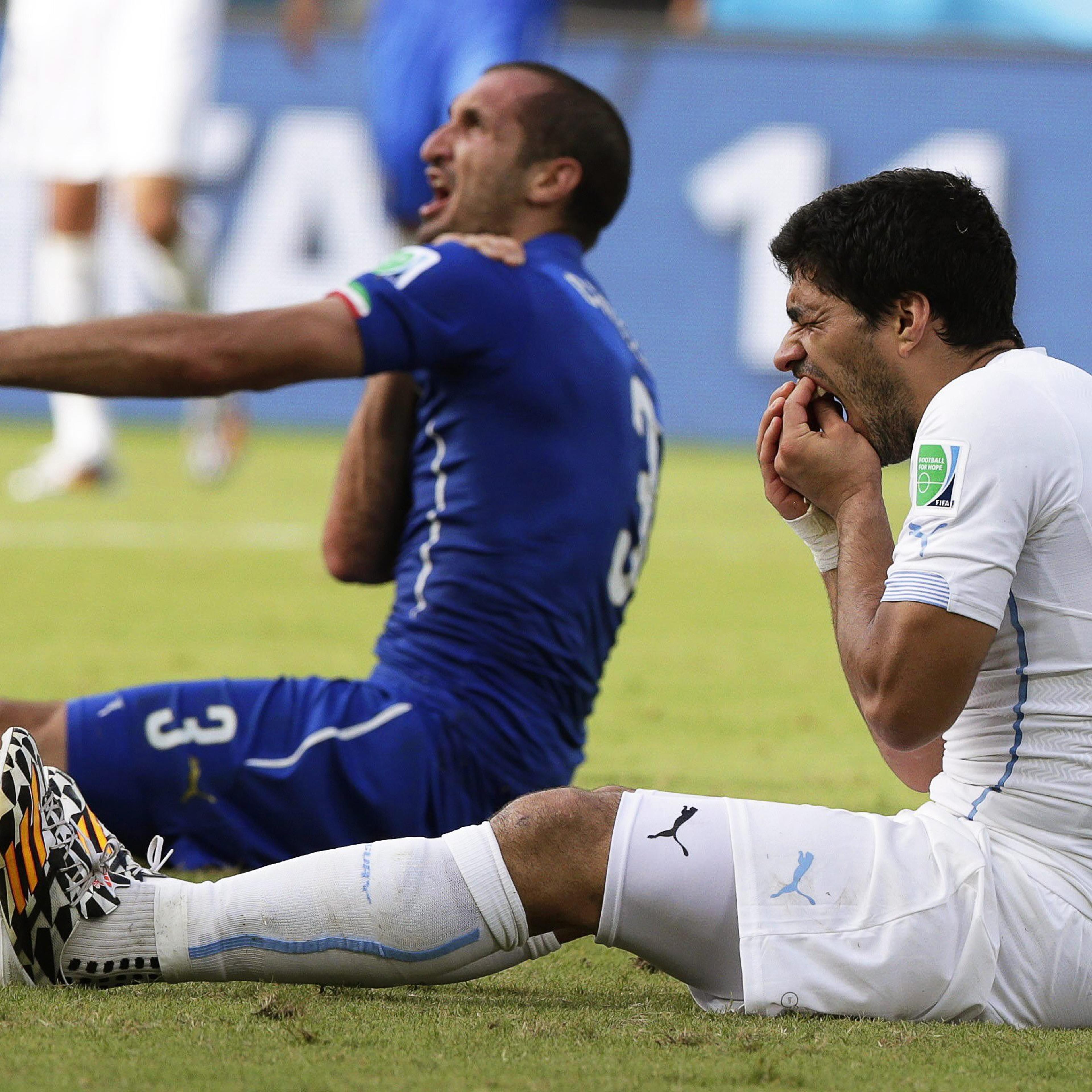 Giorgio Chiellini claims he was bitten by Uruguay's Luis Suarez during the FIFA World Cup 2014 group D preliminary round match between Italy and Uruguay at the Estadio Arena das Dunas in Natal, Brazil on June 24, 2014.