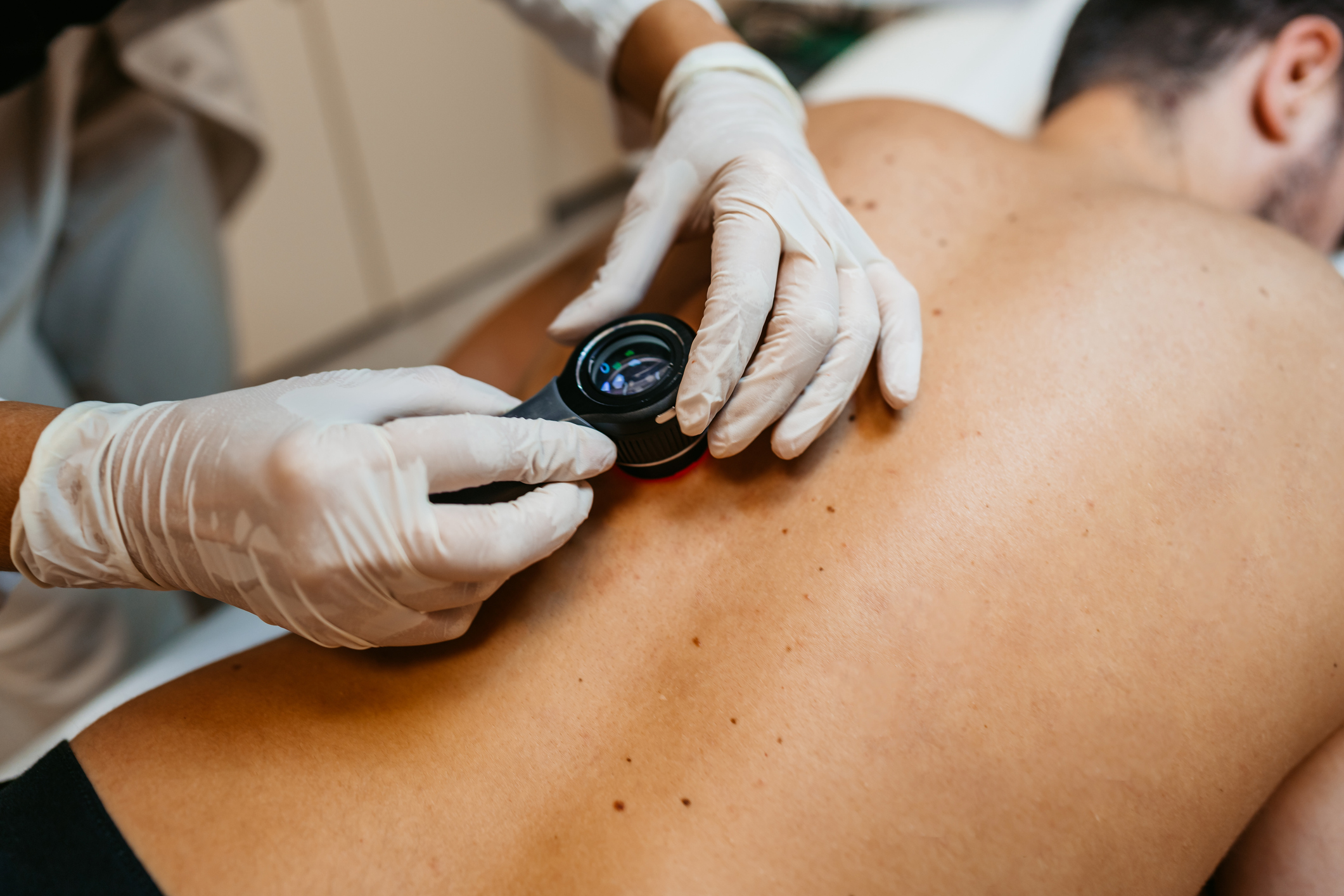 A dermatologist examines a patient's skin