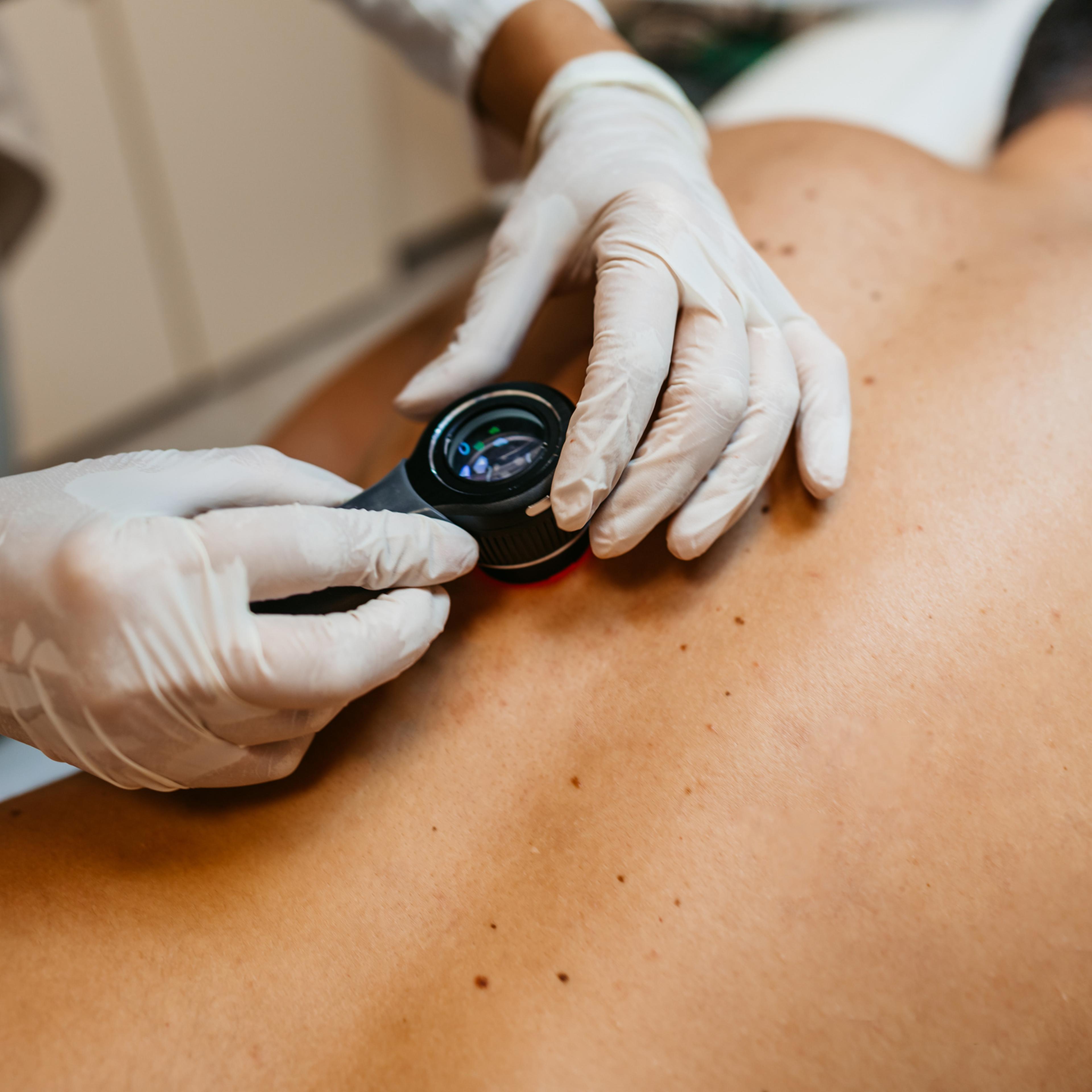 A dermatologist examines a patient's skin