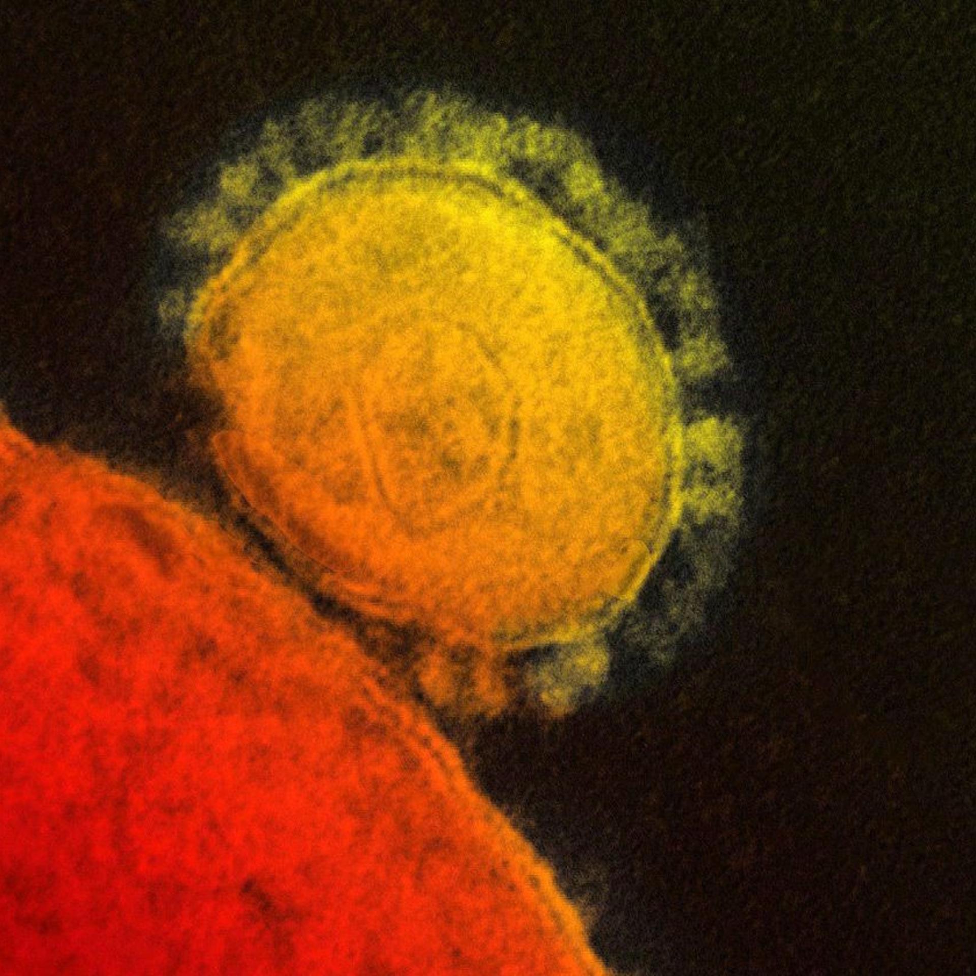 MERS