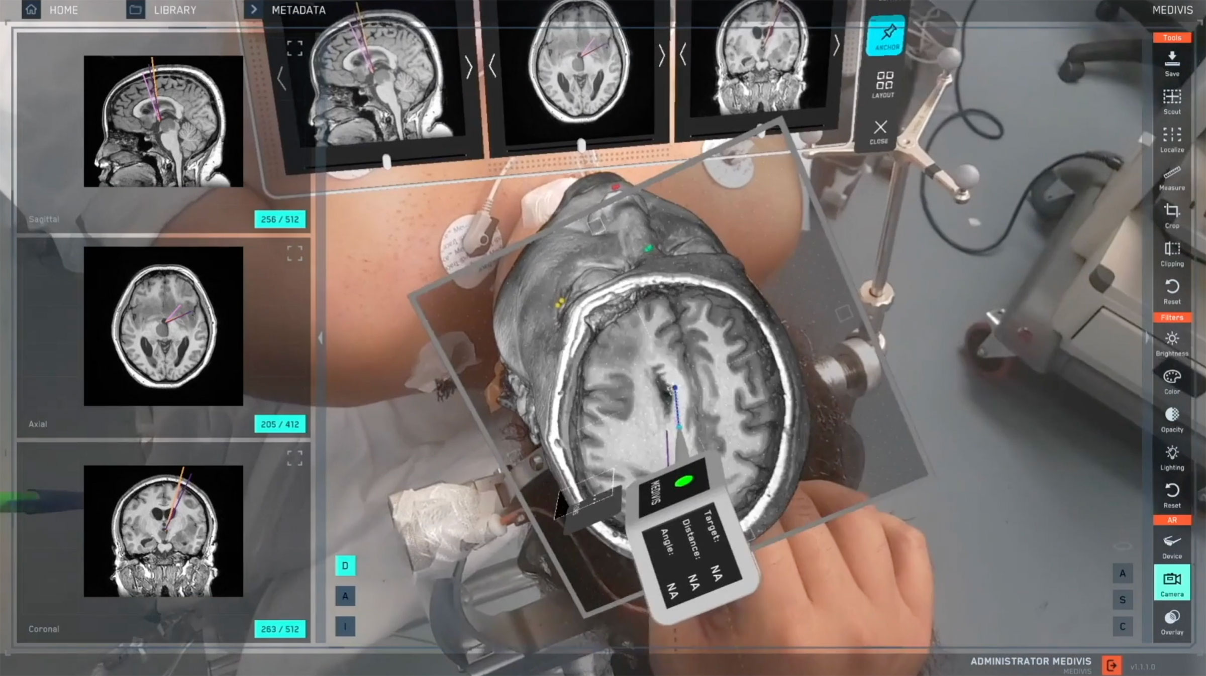 Medivis SurgicalAR: The 200 Best Inventions of 2023