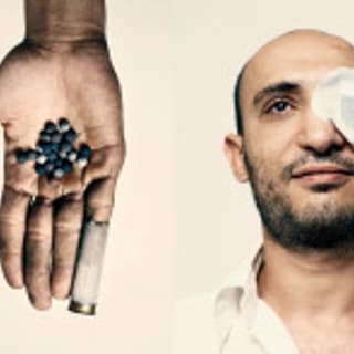 Ahmed Harara is a Cairo dentist who was blinded in one eye by a rubber bullet during clashes in January. In November, he was shot in his other eye. Now he is completely blind. "As they say in America, power of the people will change everything," Harara says.