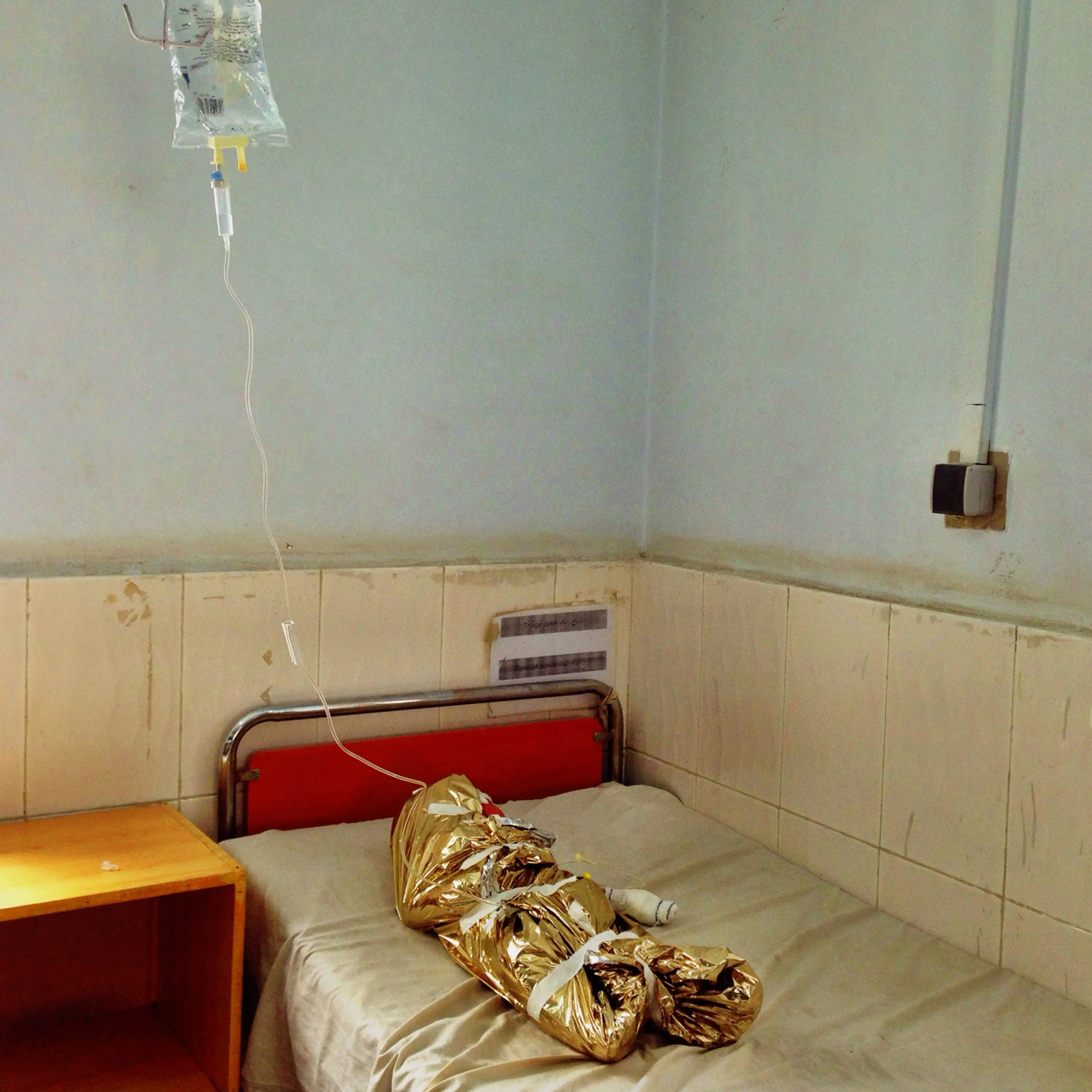 Lashkar Gah, Helmand, Afghanistan. In Boost Hospital in the provincial capital, a young girl who suffered burns to over 50% of her body lies in an observation room after an accident with an oil lamp at home. Boost Hospital is administered by Medicines Sa