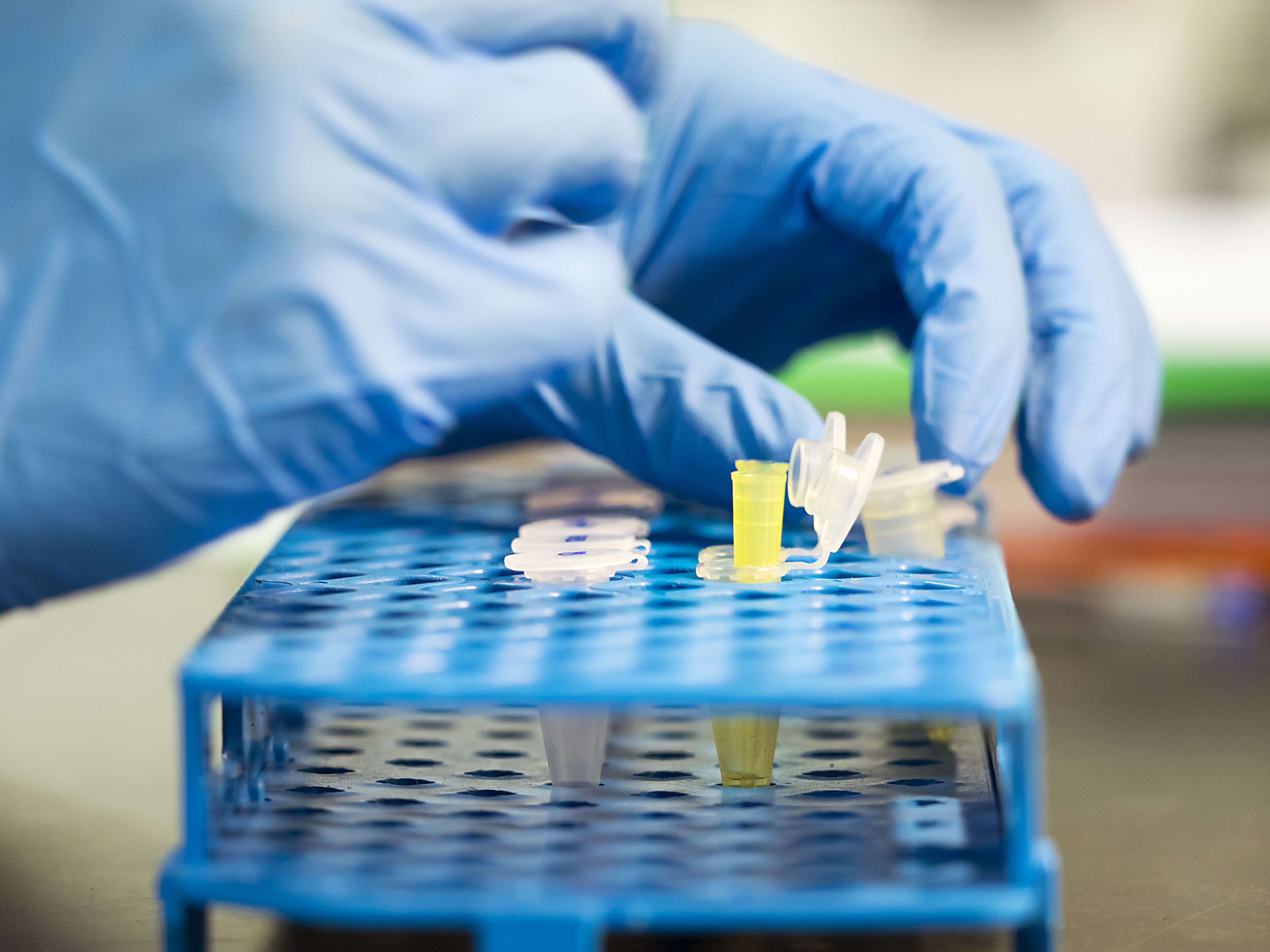 Hands of a scientific investigator in a laboratory of molecular biology realizing works of extraction of DNA in plants. Spain.