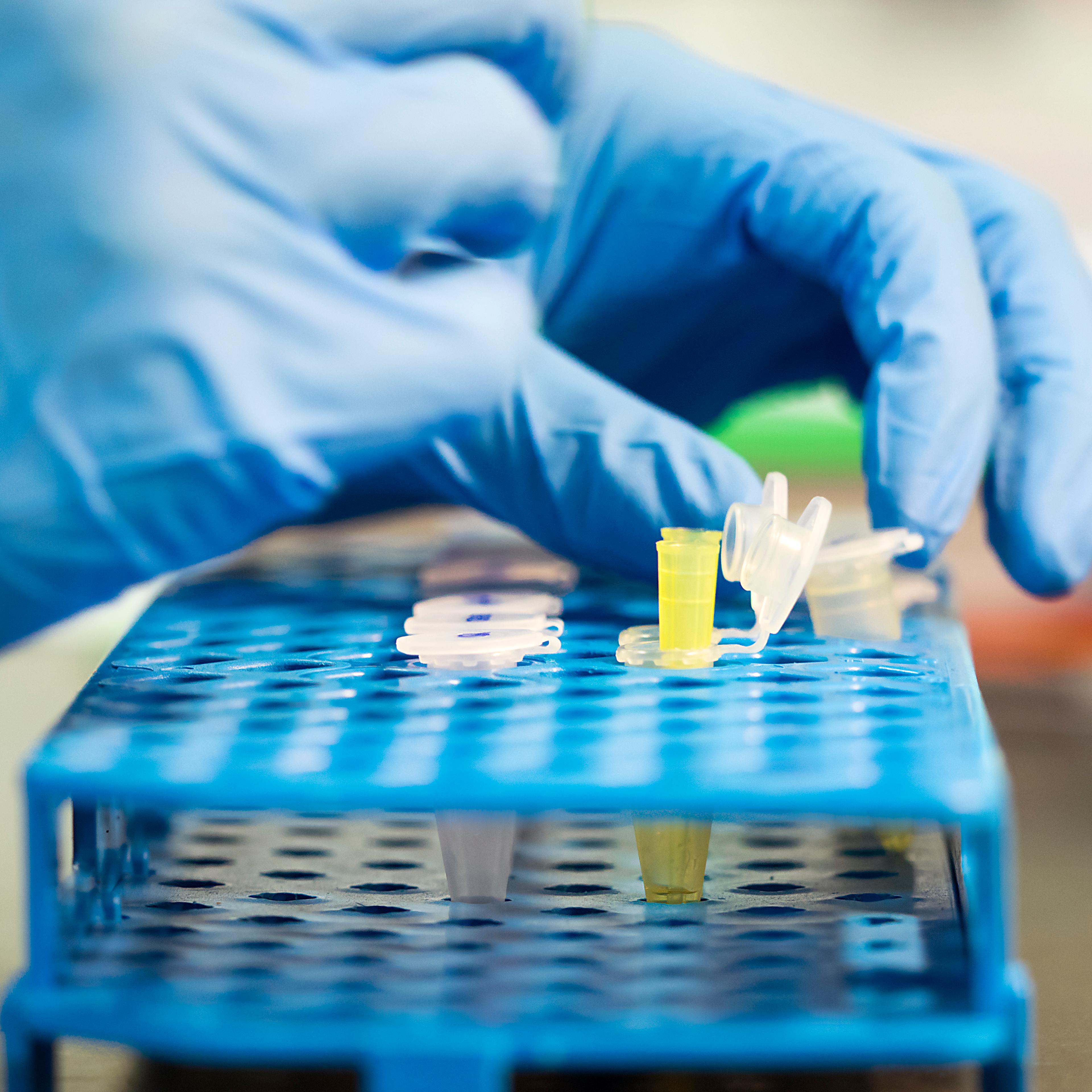 Hands of a scientific investigator in a laboratory of molecular biology realizing works of extraction of DNA in plants. Spain.