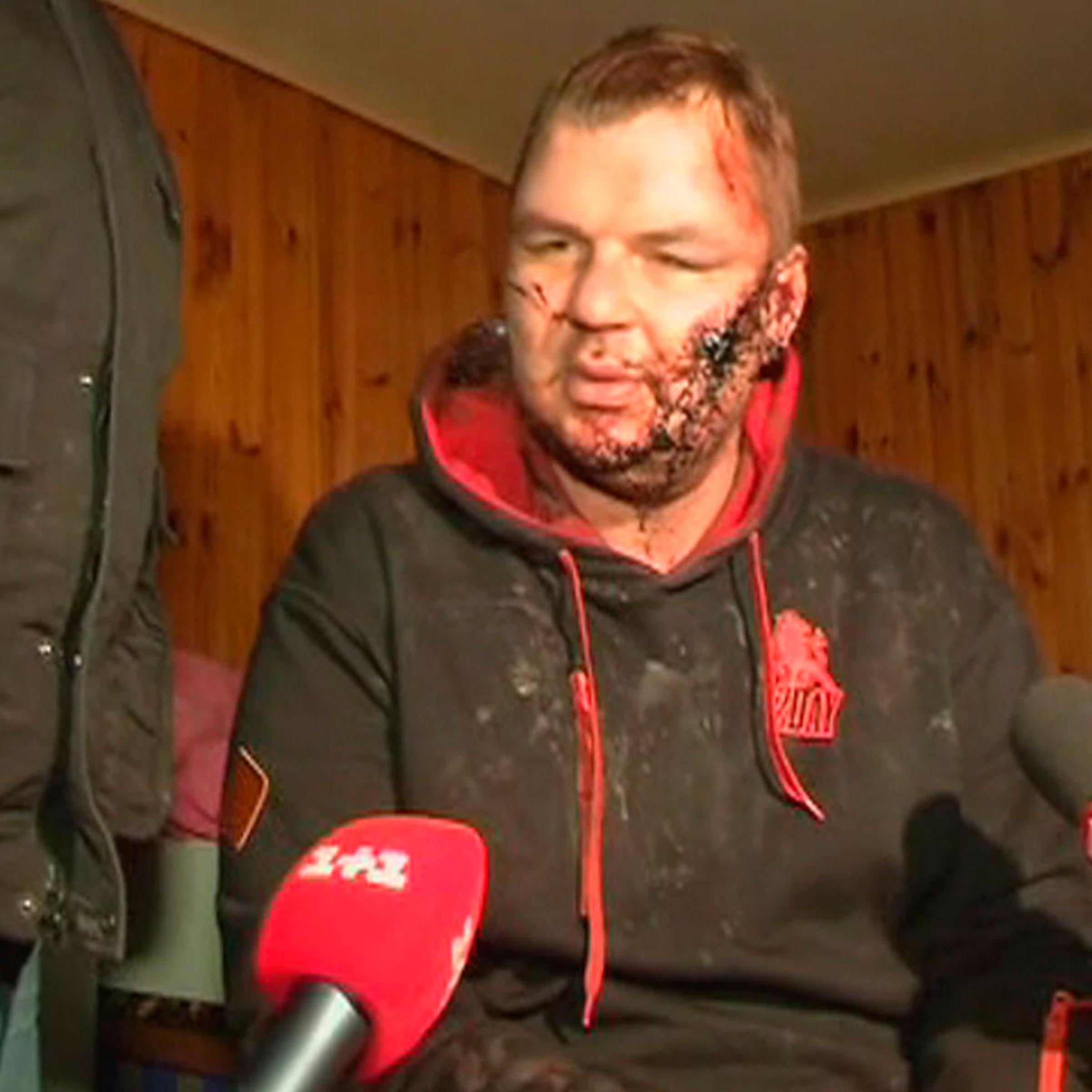 Dmytro Bulatov, 35, one of the leaders of anti-government protest motorcades called 'Automaidan', speaks to journalists after being found near Kiev, Jan. 30, 2014.