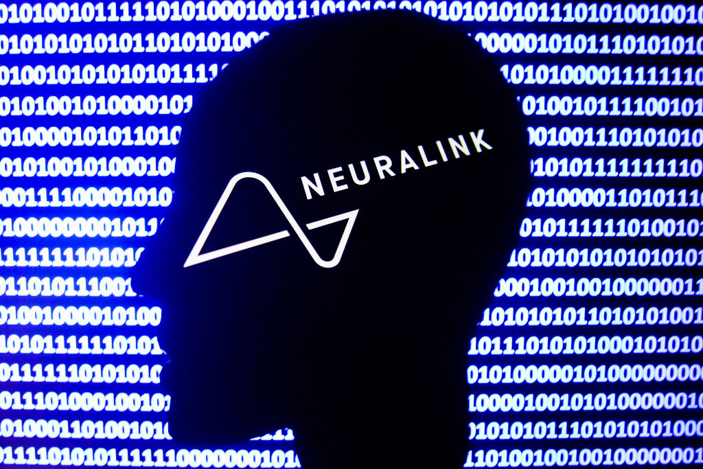 Neuralink Implants Brain Chip in First Human: What It Means