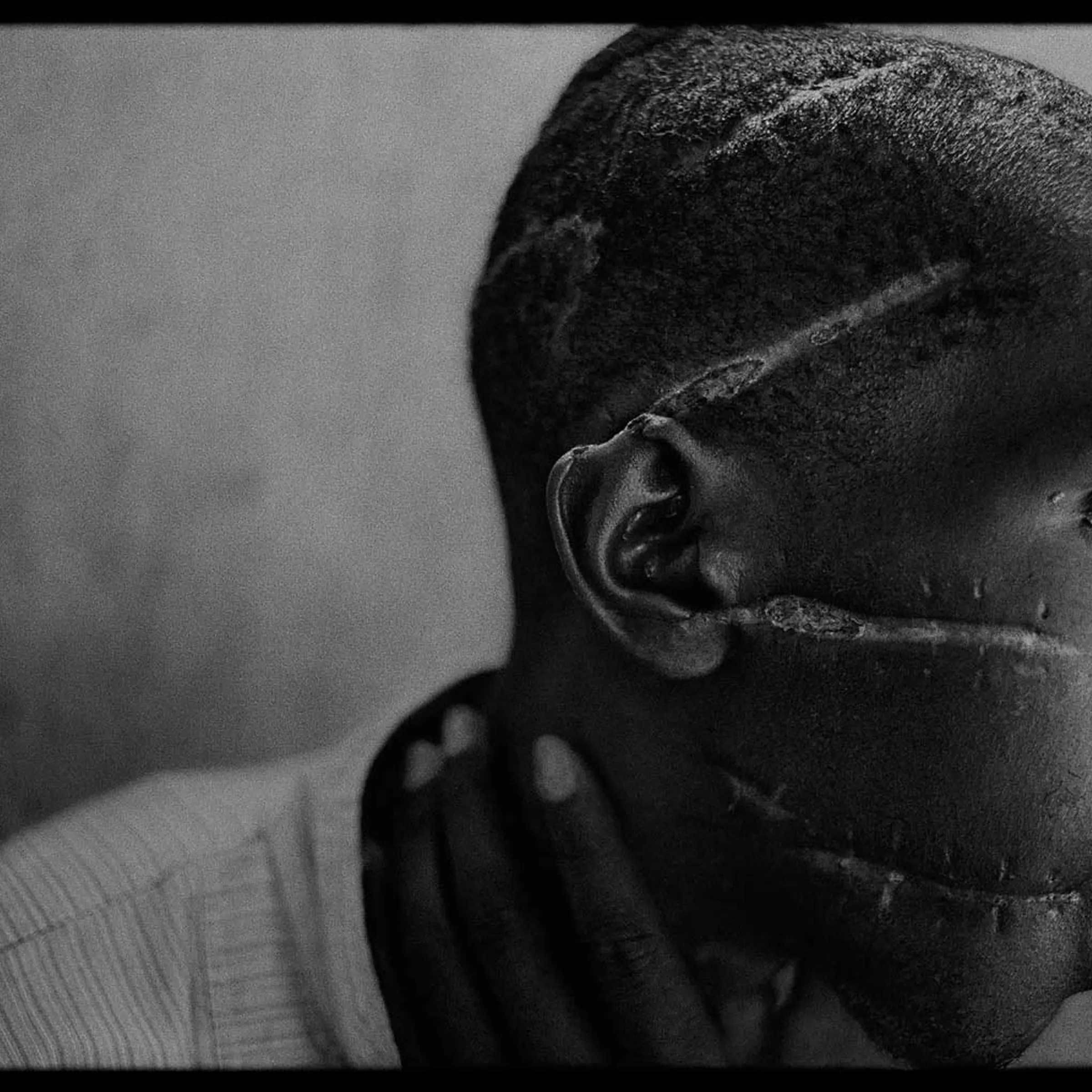 A Hutu man who did not support the genocide had been imprisoned in the concentration camp, starved and attacked with machetes. He managed to survive after he was freed and was placed in the care of the Red Cross, Rwanda, 1994.
