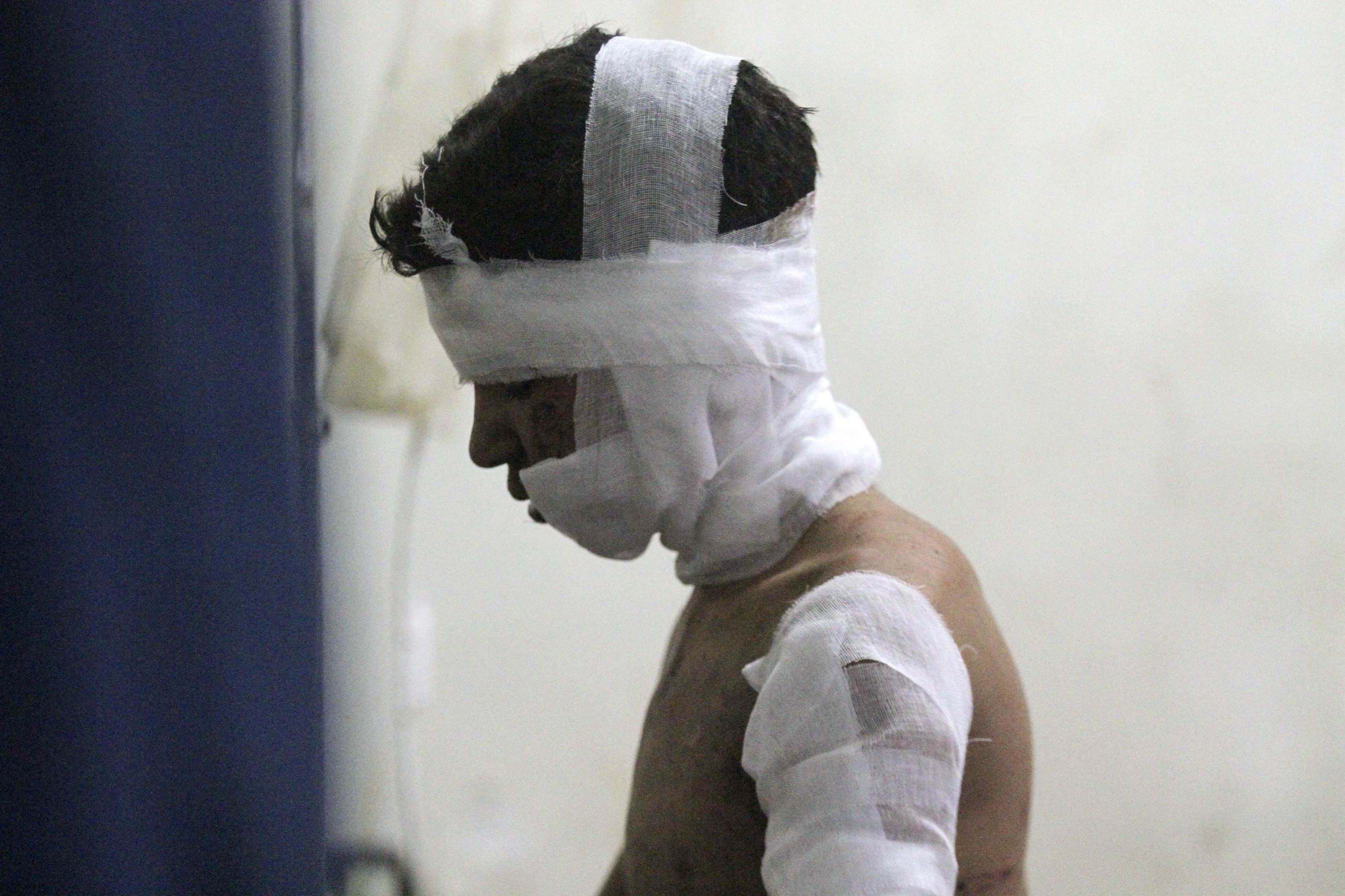 An injured boy rests in a field hospital after air strikes near Damascus