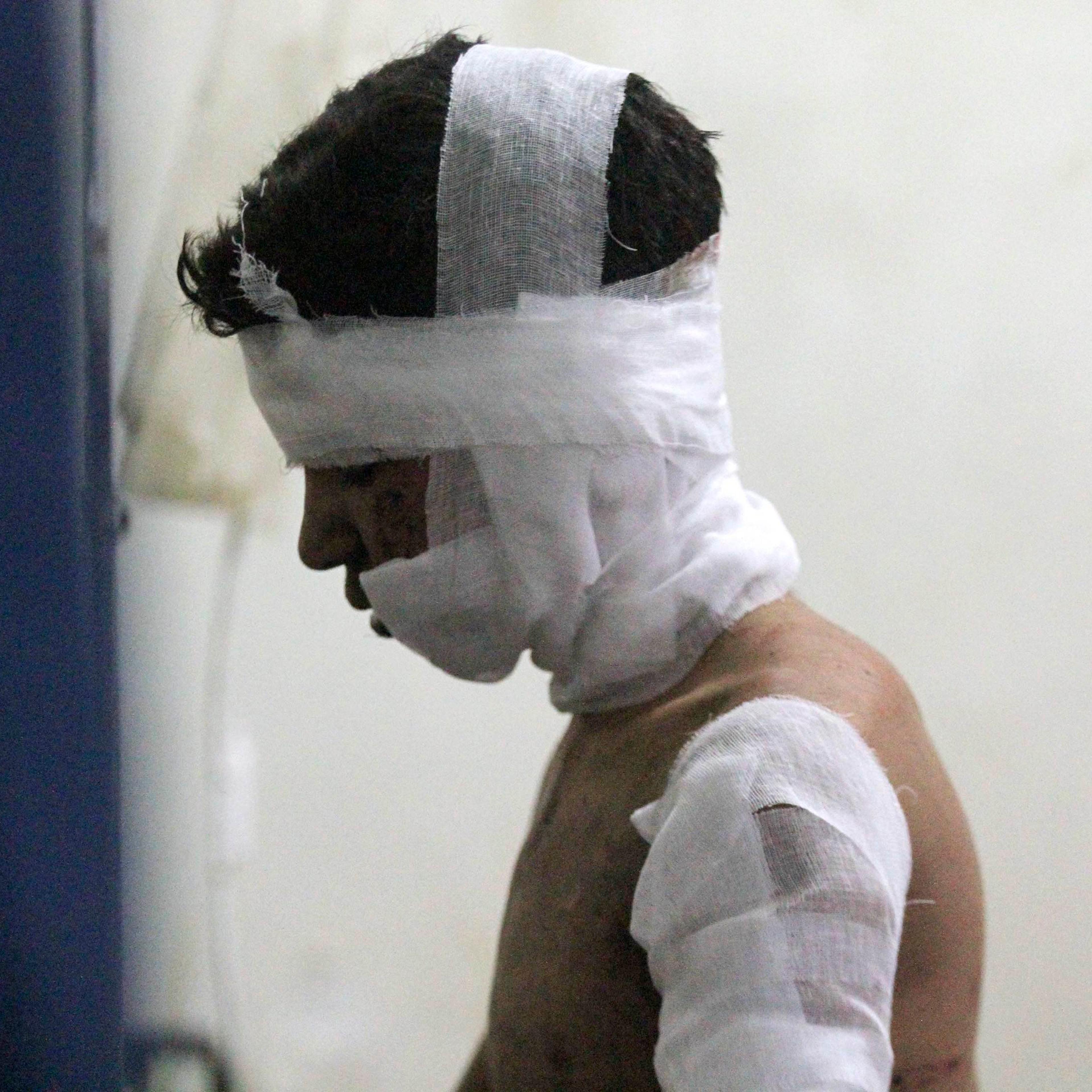 An injured boy rests in a field hospital after air strikes near Damascus