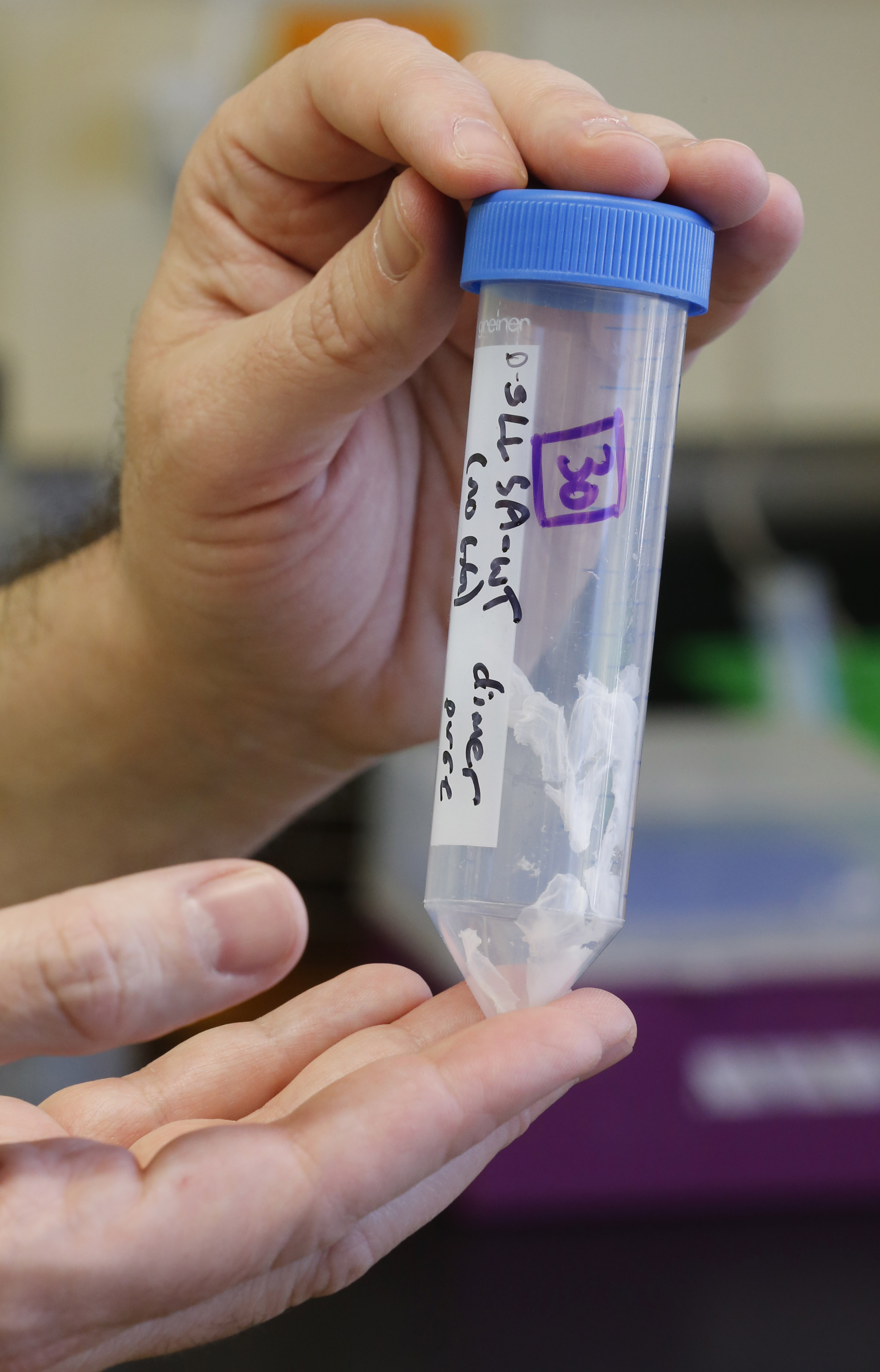University of Utah Researchers Work Toward Cure For Ebola Strains